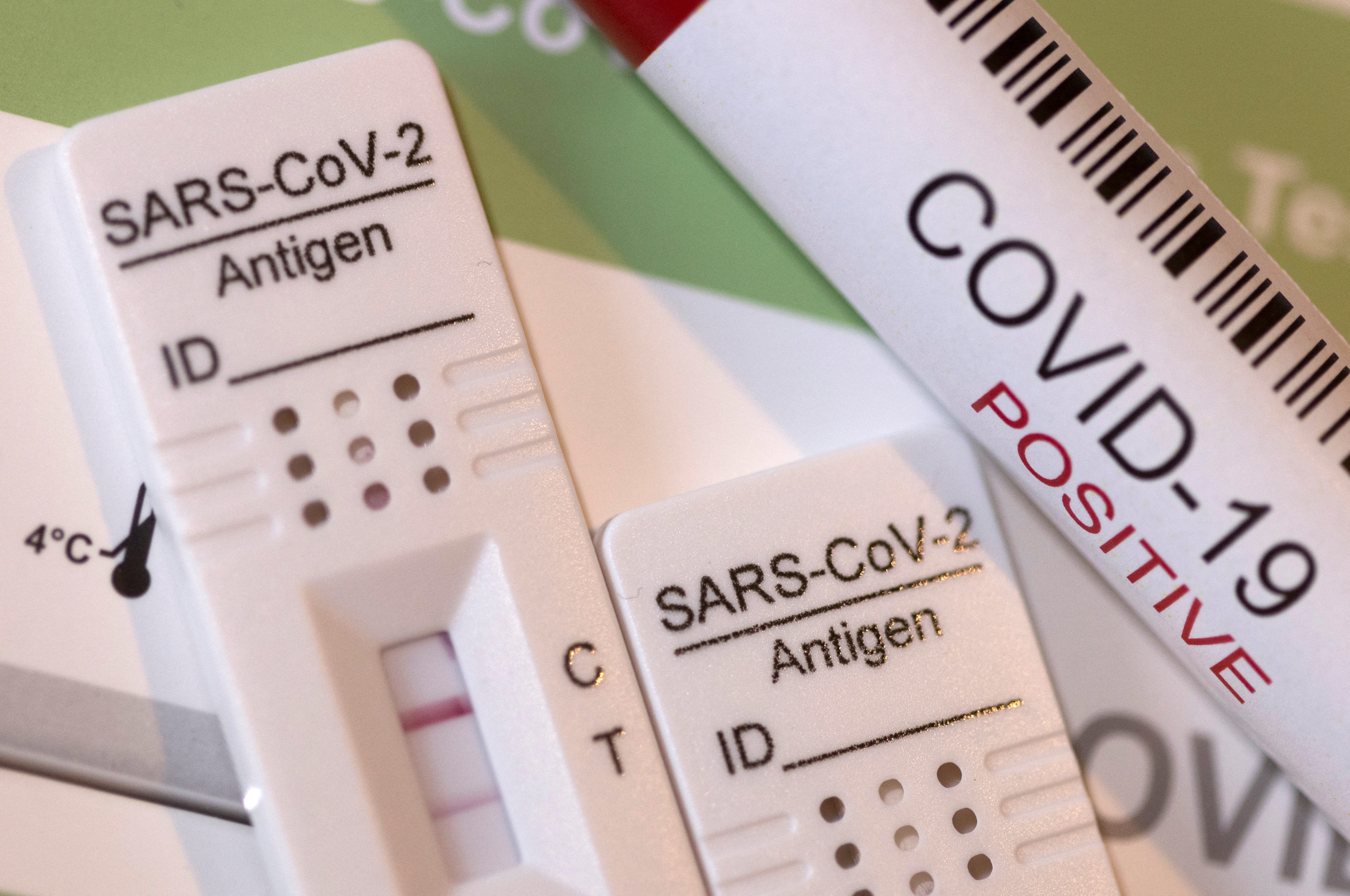 La detección de anticuerpos específicos contra el SARS-CoV-2 se realiza mediante el uso de tiras reactivas (Reuters)