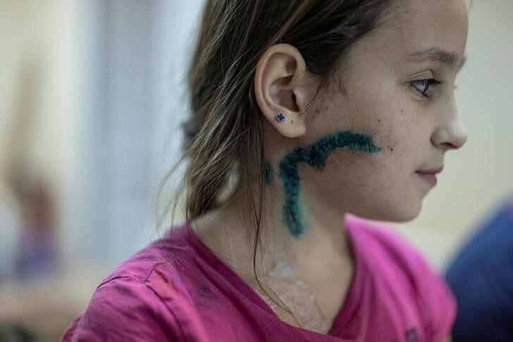 Foto de Milana, una niña de 11 años que se recupera de las heridas en un hospital en Zaporizhzhia (REUTERS/Marko Djurica)