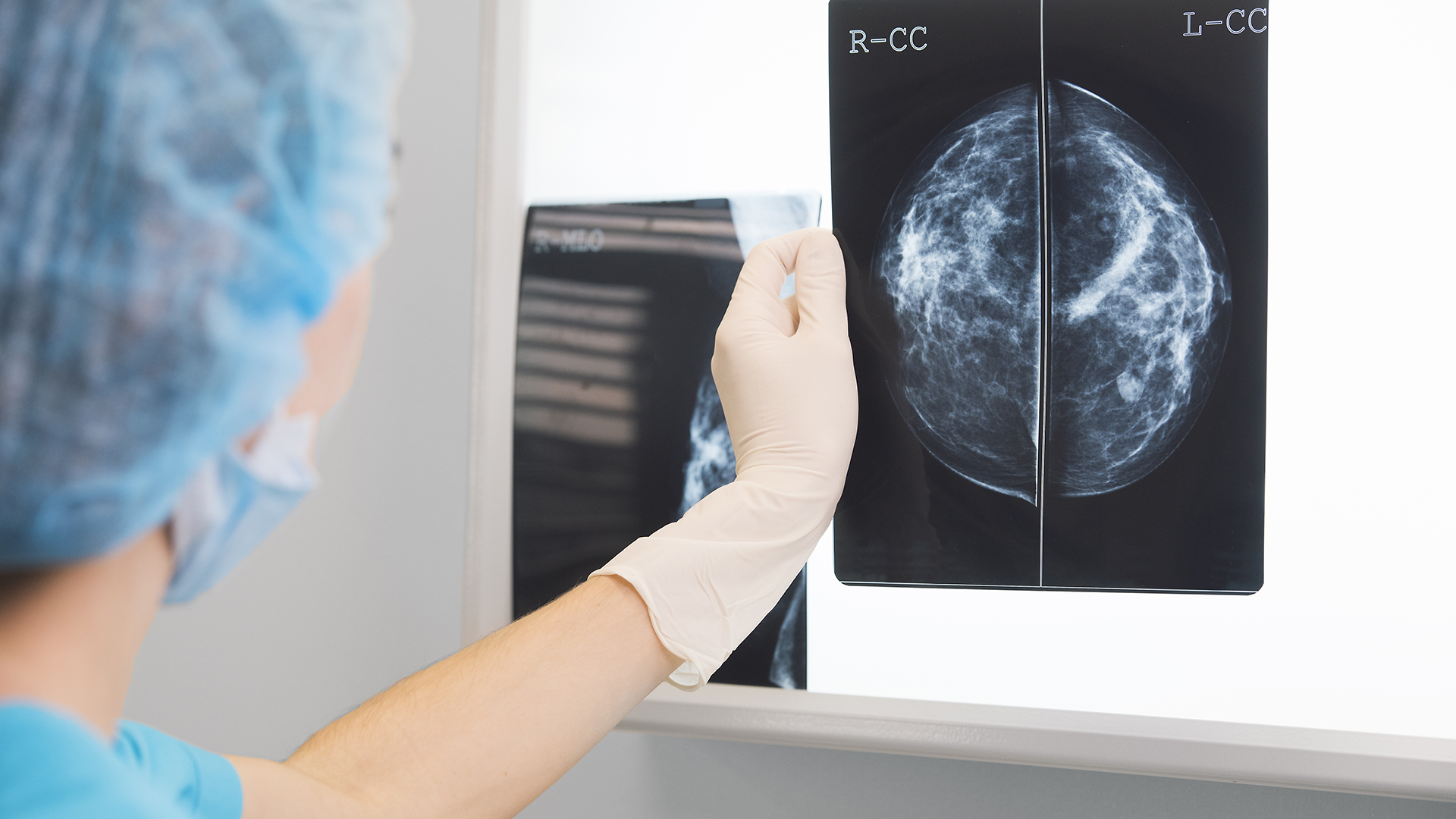 A partir de los 40 años de edad, es conveniente realizar una mamografía en forma anual  (Getty)