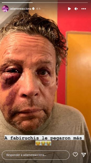 El actor subió esta selfie después de ser intervenido quirúrgicamente por las múltiples fracturas que tenía en el rostro. (Captura Twitter)