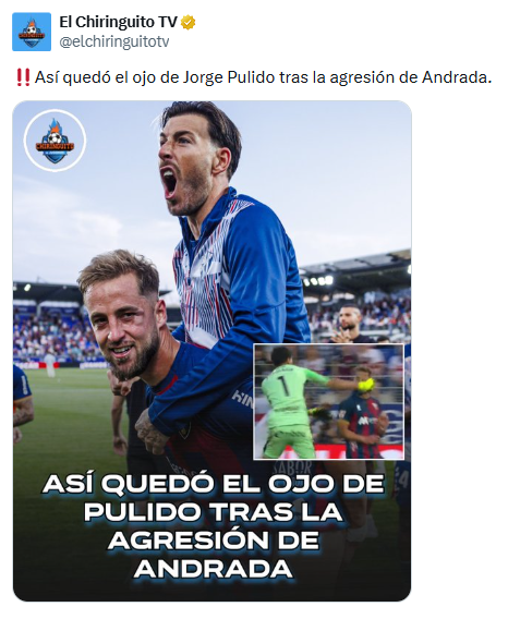 Ojo morado y hielo: las im&aacute;genes de las secuelas que sufri&oacute; el futbolista espa&ntilde;ol agredido por Esteban Andrada 