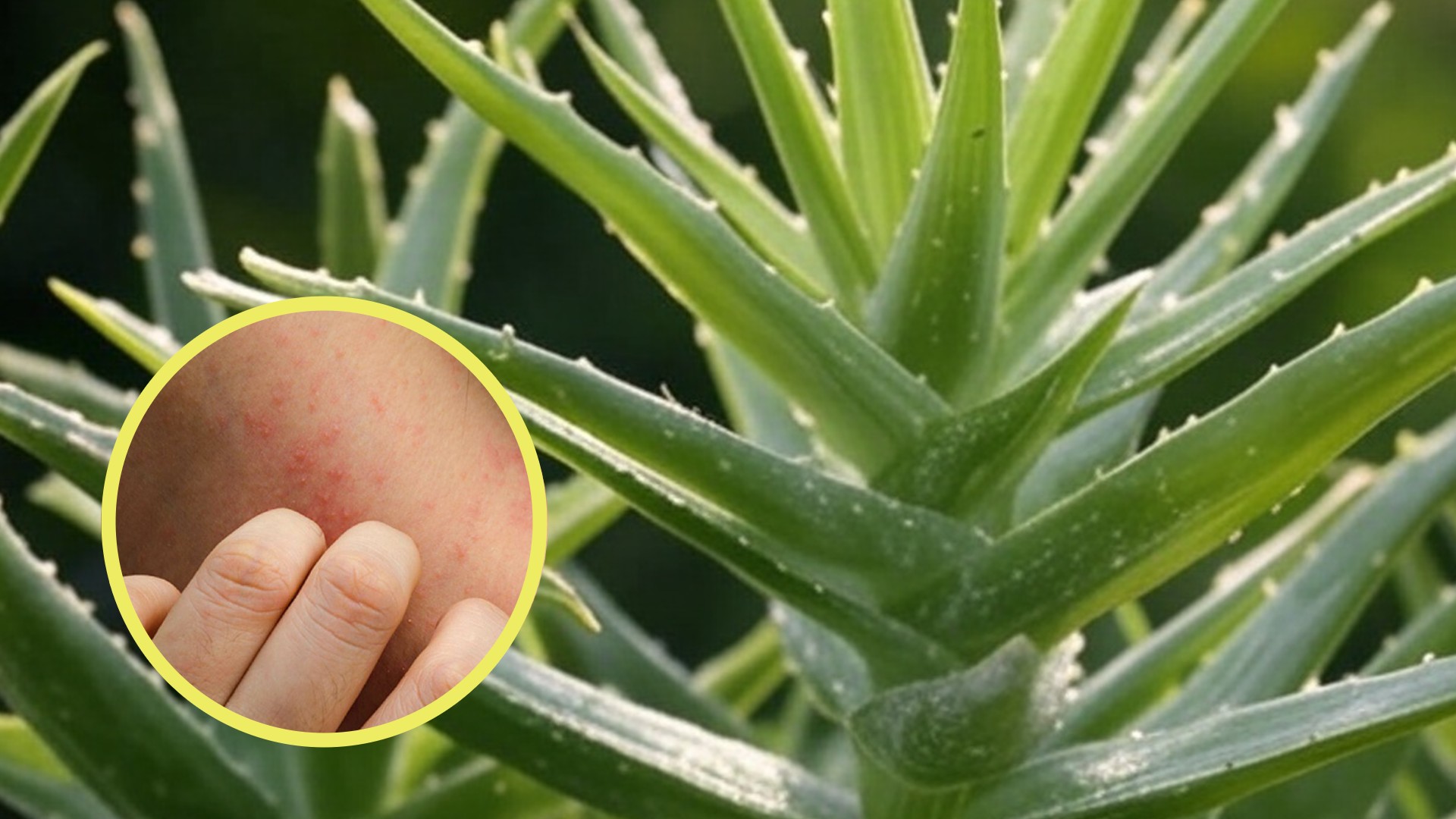 Cuidado! Estos son los riesgos que debes conocer del aloe vera o sbila  antes de usarla - Infobae