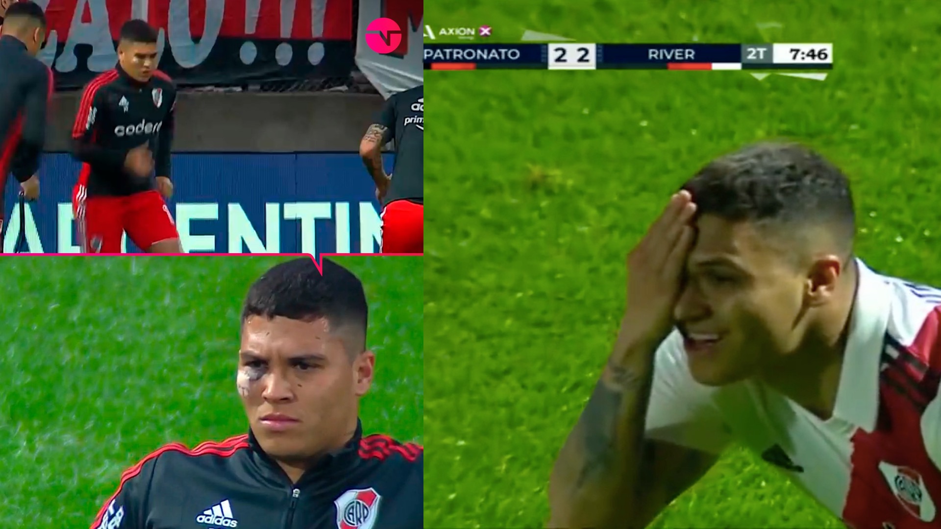 Con preocupante moretón en el rostro, Juanfer Quintero jugó los cuartos de final de la Copa Argentina con River Plate