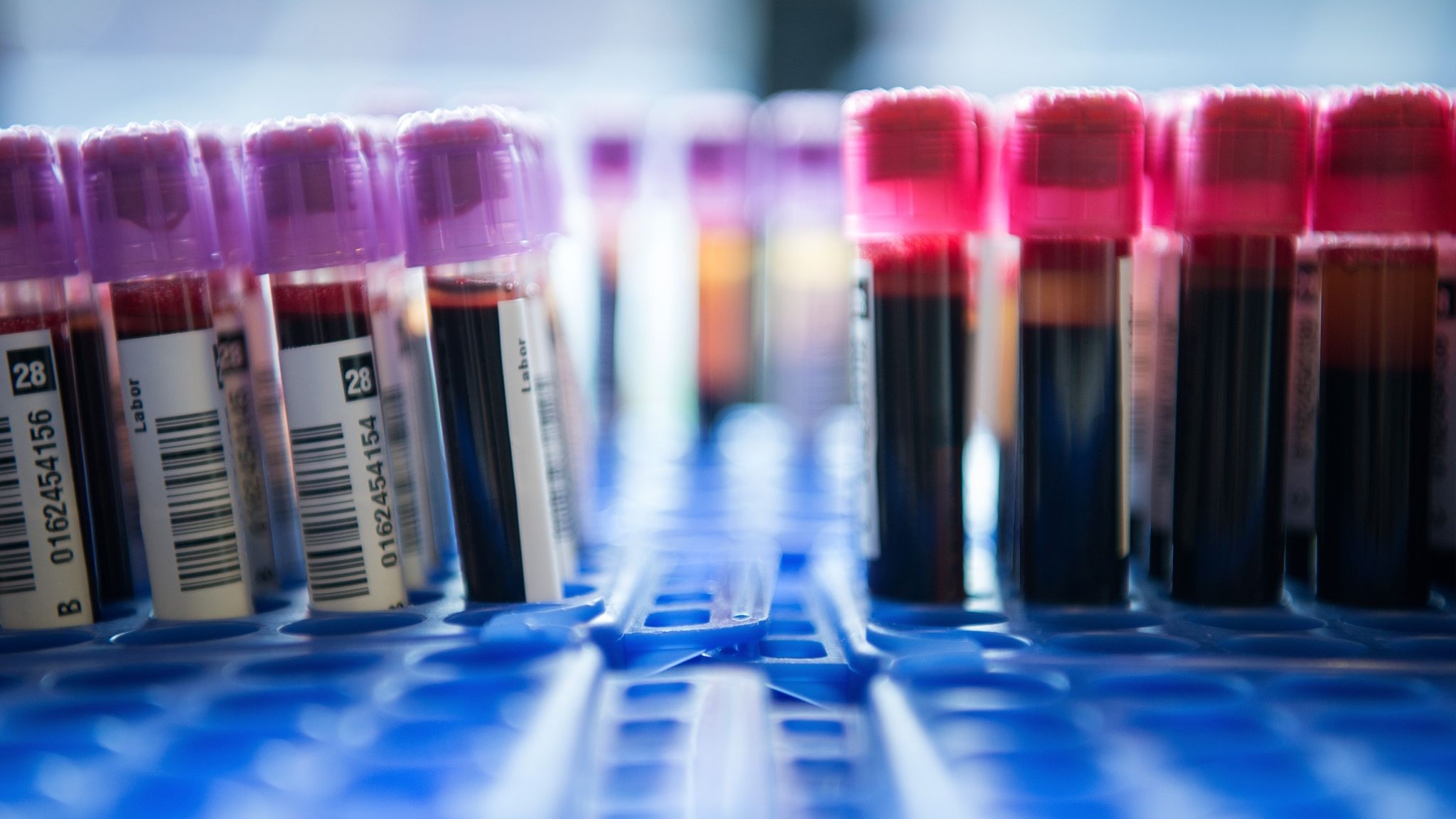 Investigación sobre el cáncer: las proteínas de la sangre podría advertir riesgos siete años antes del diagnóstico