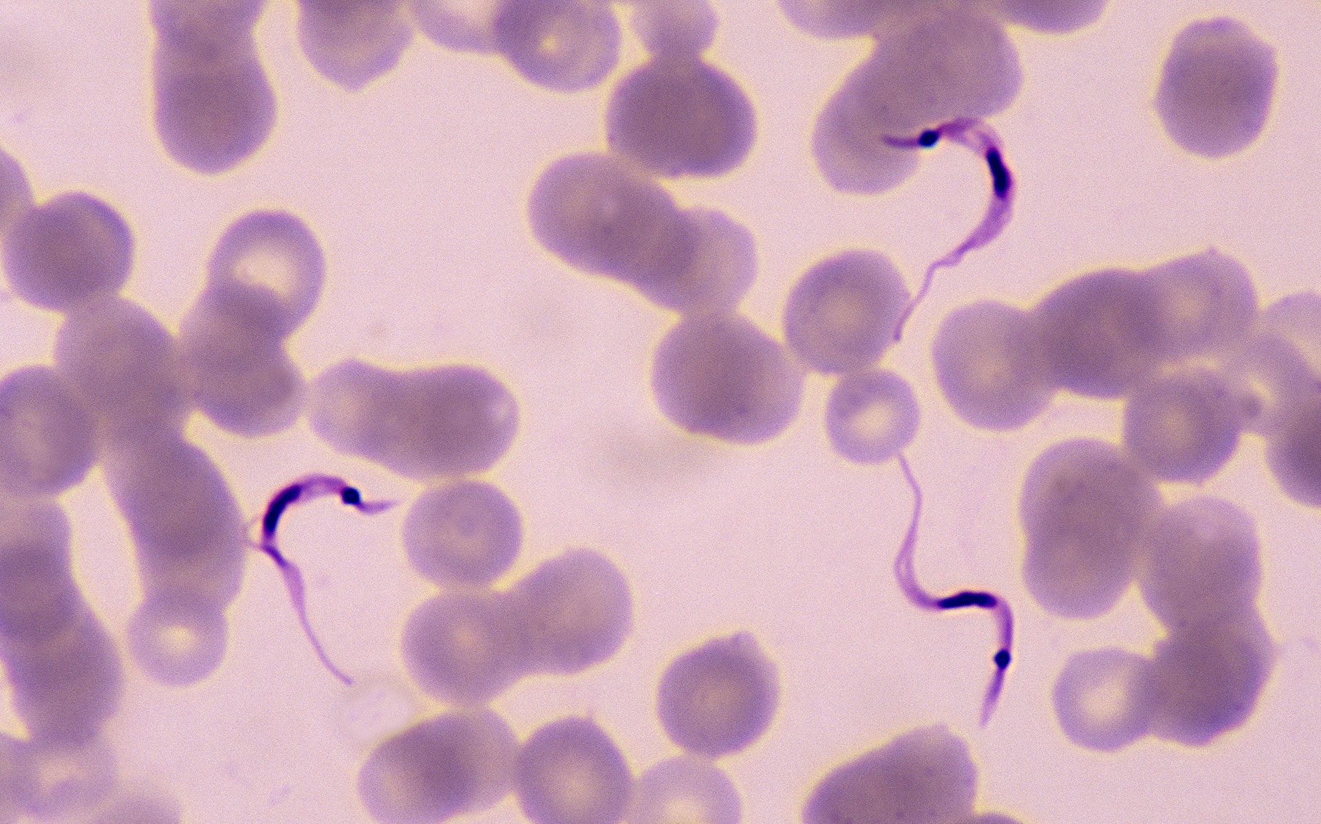 Así luce el parásito Trypanosoma cruzi cuando infecta a una persona. Se puede observar con una forma alargada y de un color más oscuro / Crédito: Getty