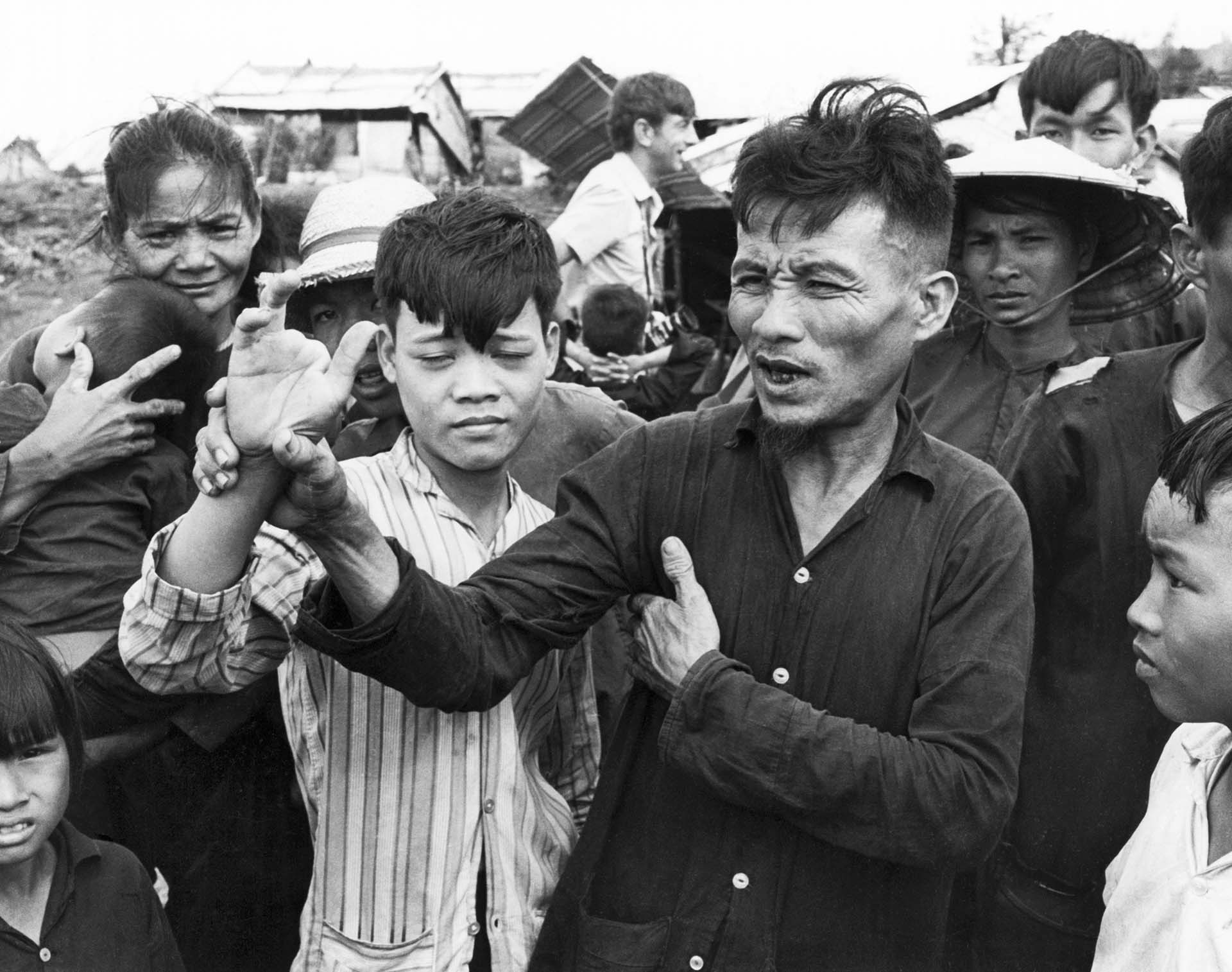 El campesino de Vietnam del Sur, Do Chuc, sostiene la mano mutilada de su hijo, Do Ba, mientras les cuenta a los periodistas sobre el asesinato de 370 civiles en la aldea de Tu Cung, que se conoció como la Masacre de My Lai (Underwood Archives/Getty Images)