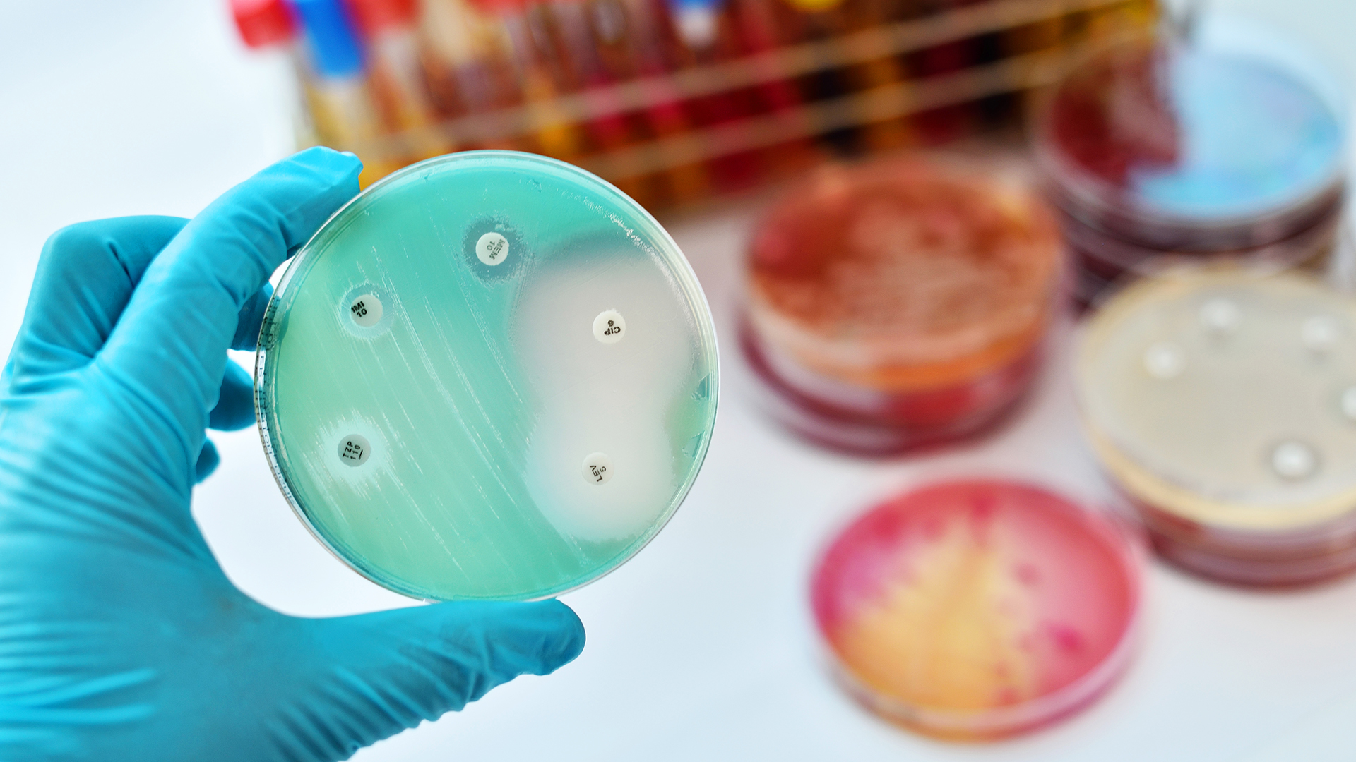 La resistencia antimicrobiana ocurre cuando los microrganismos patógenos causan enfermedades y se vuelven resistentes a los medicamentos que se utilizan para combatirlos / (Getty)