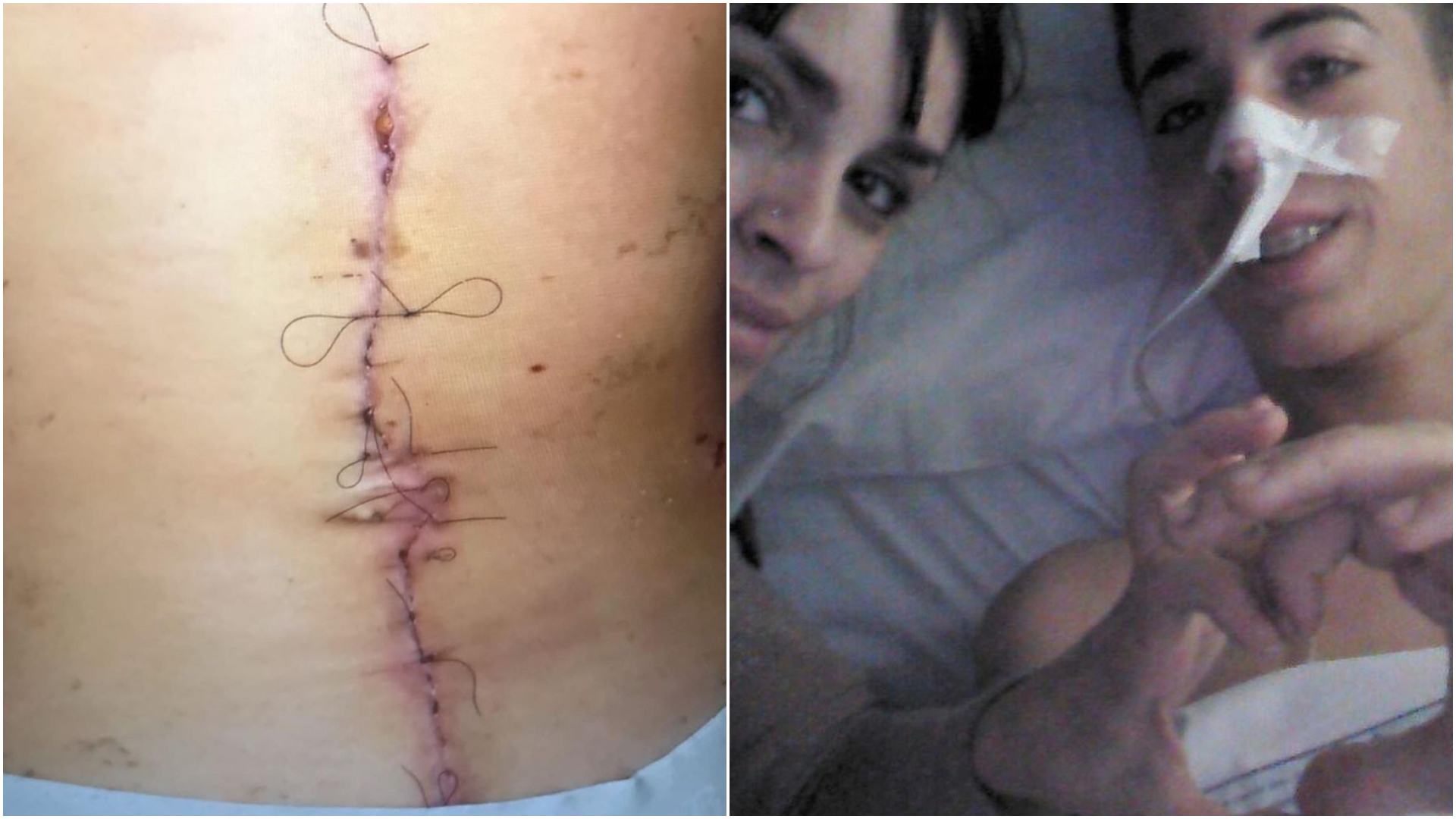 Singer Reveals More Photos Of Scars Left By A Motorcycle Accident At Age 17