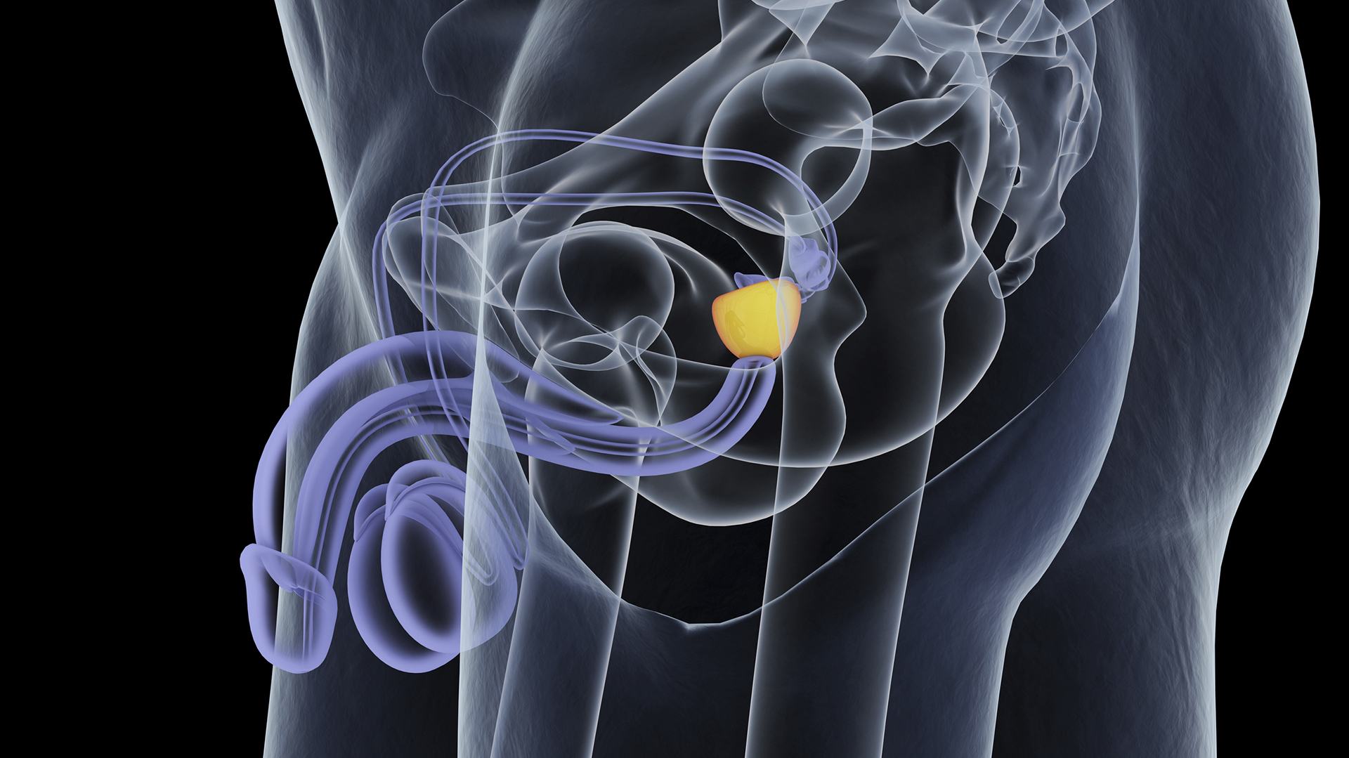 El cáncer de próstata es de los que tienen mayor incidencia en hombes de toda la región de las Américas