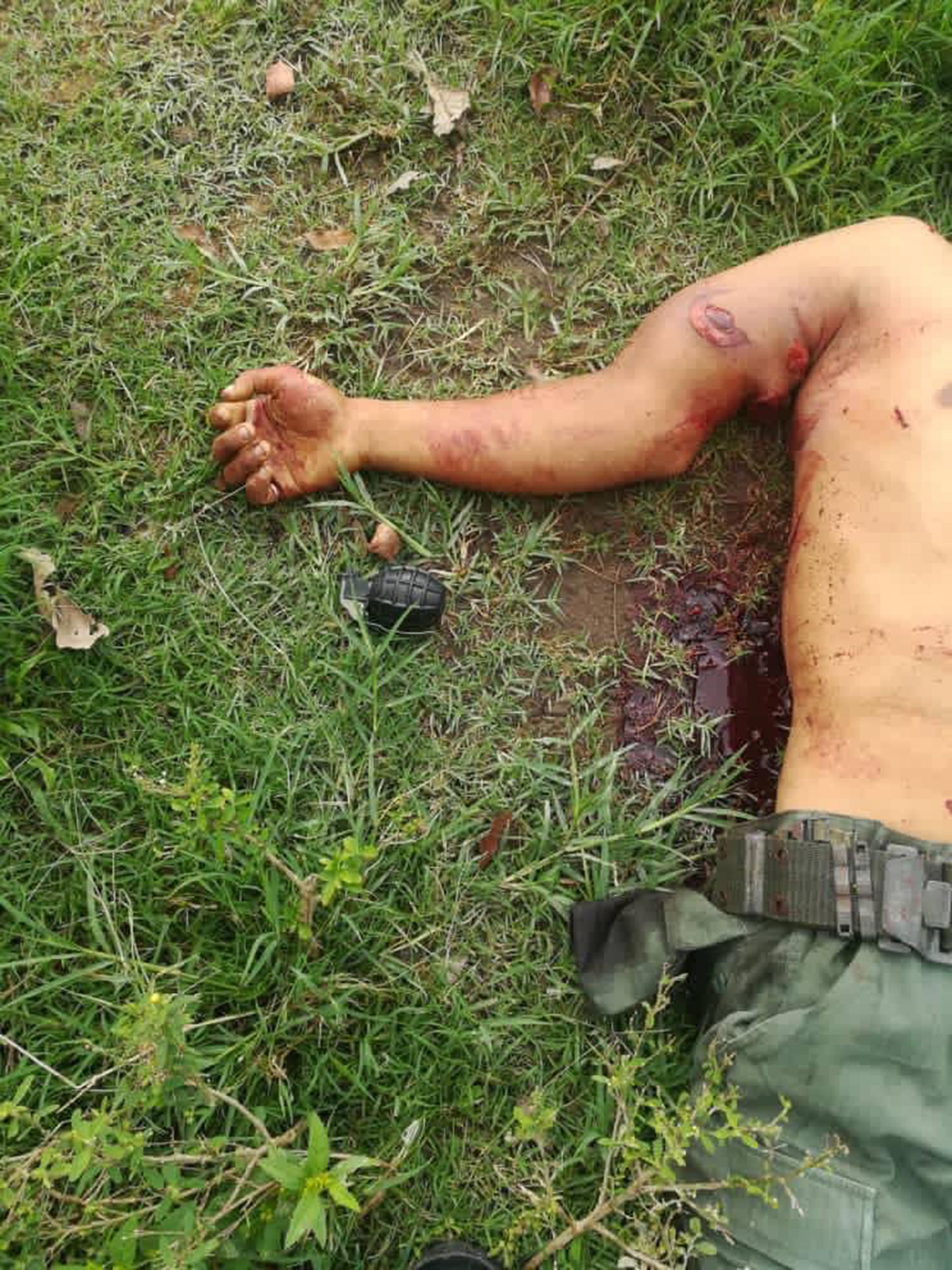 El cuerpo de un hombre con una granada a su lado (@bgalindo74)