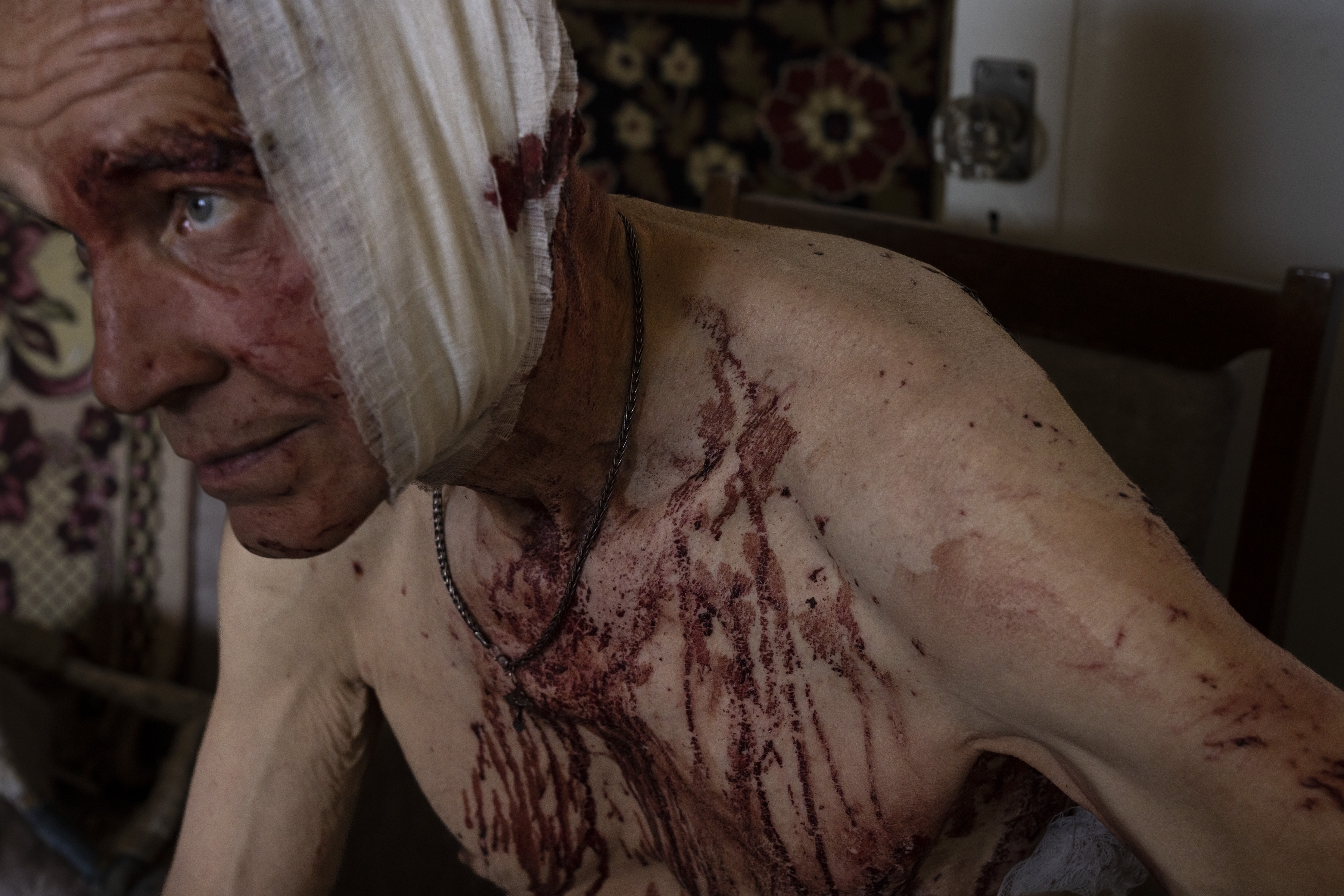 Volodymyr, herido por un golpe, se sienta en su apartamento dañado en Kramatorsk, región de Donetsk, este de Ucrania, el 7 de julio de 2022 (Foto AP/Nariman El-Mofty)