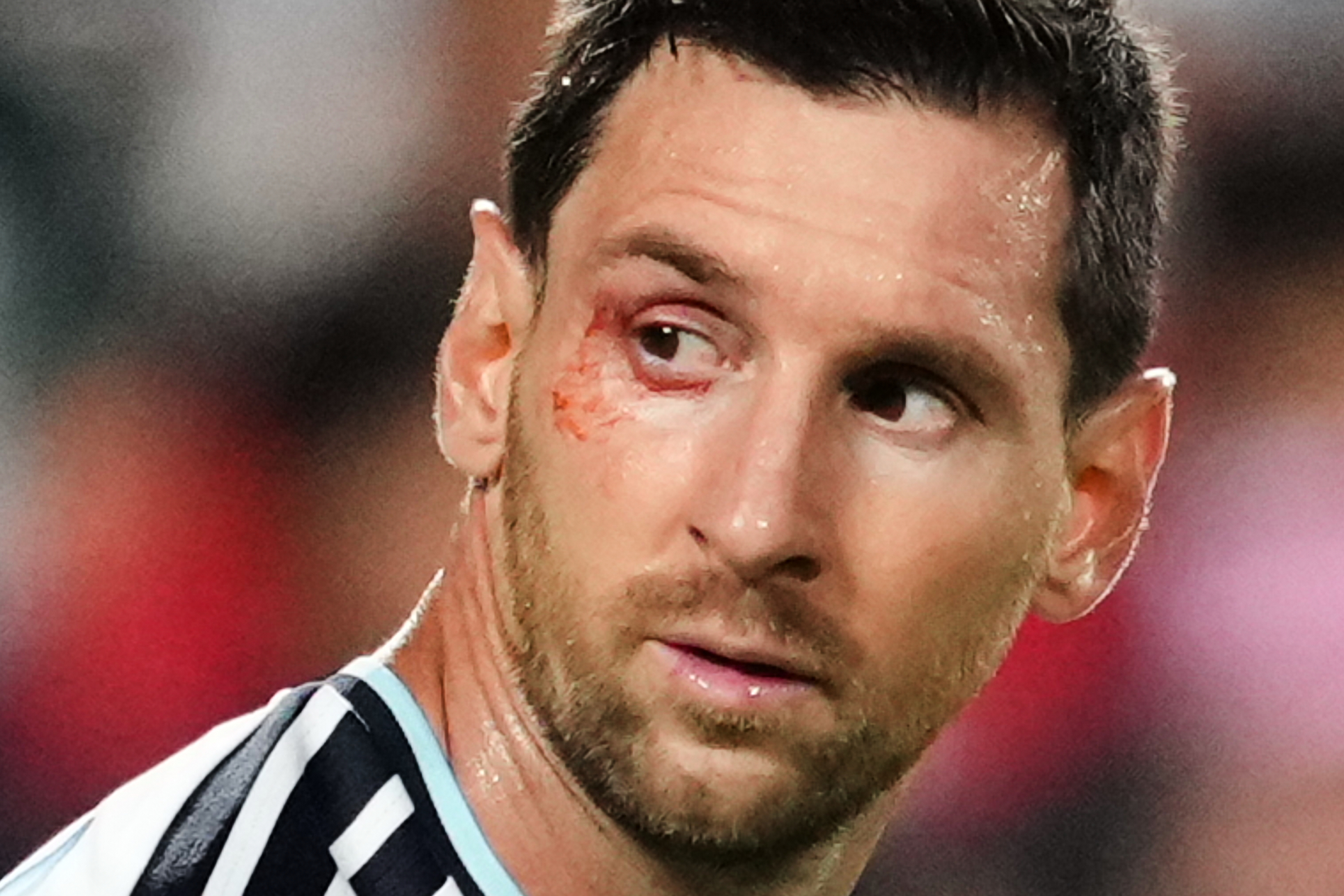 El corte en el ojo que sufri&oacute; Lionel Messi durante el duelo entre Argentina y Suiza del Mundial 2026