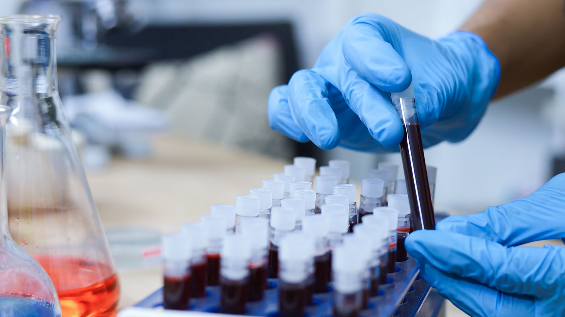 La prediabetes se puede determinar a partir de análisis de sangre indicados tras la consulta médica (Getty Images)