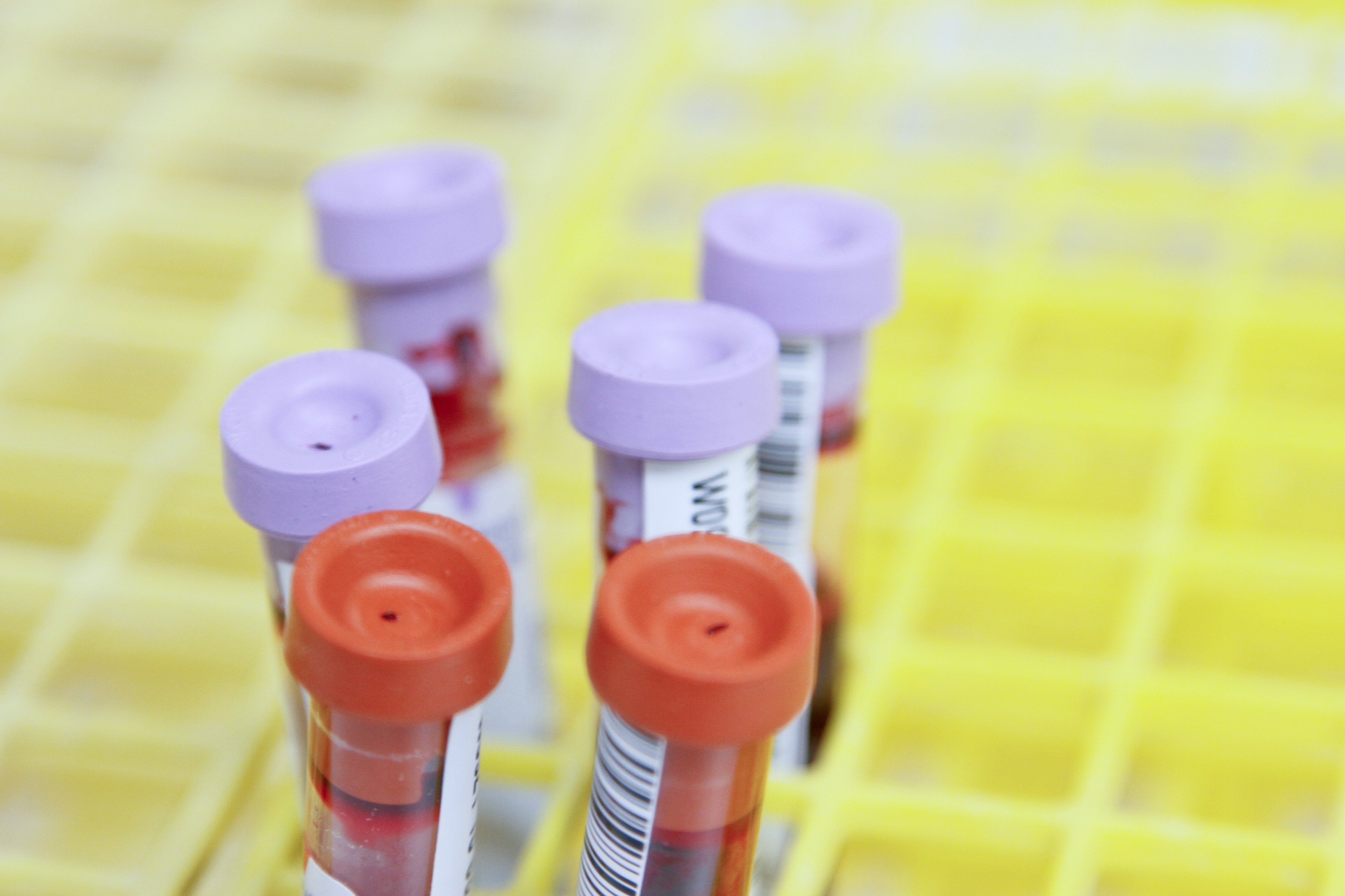 Este dispositivo analiza y separa las células de la sangre de las cancerígenas. (Unsplash)