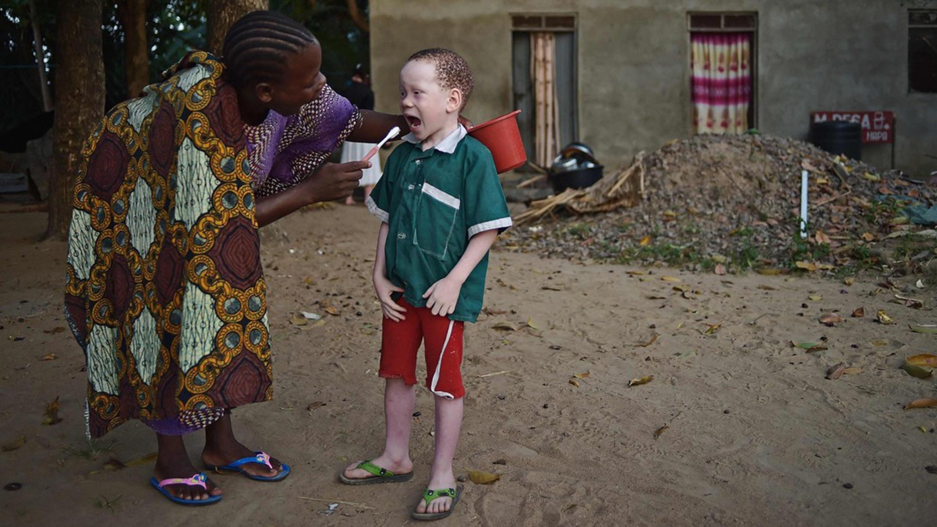 En un comeinzo, los bebés albinos simplemente desaparecían al momento de nacer. La creencia de sus familiares era, en general, que los pequeños resultaban demoníacos y traían mala suerte(AFP)