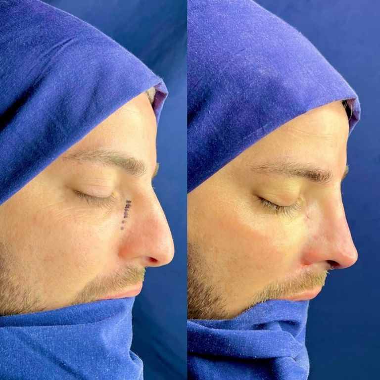 El doctor Santiago Echeverría compartió el antes y después de la cirugía que se hizo Lhoan