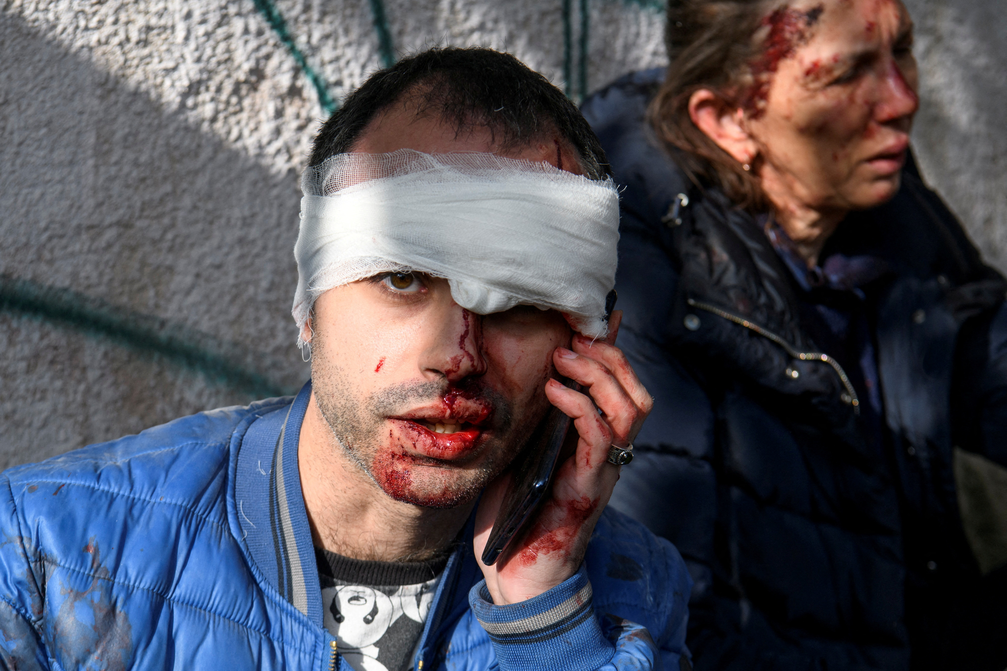 Un hombre herido tras el ataque ruso en Kiev (Reuters)