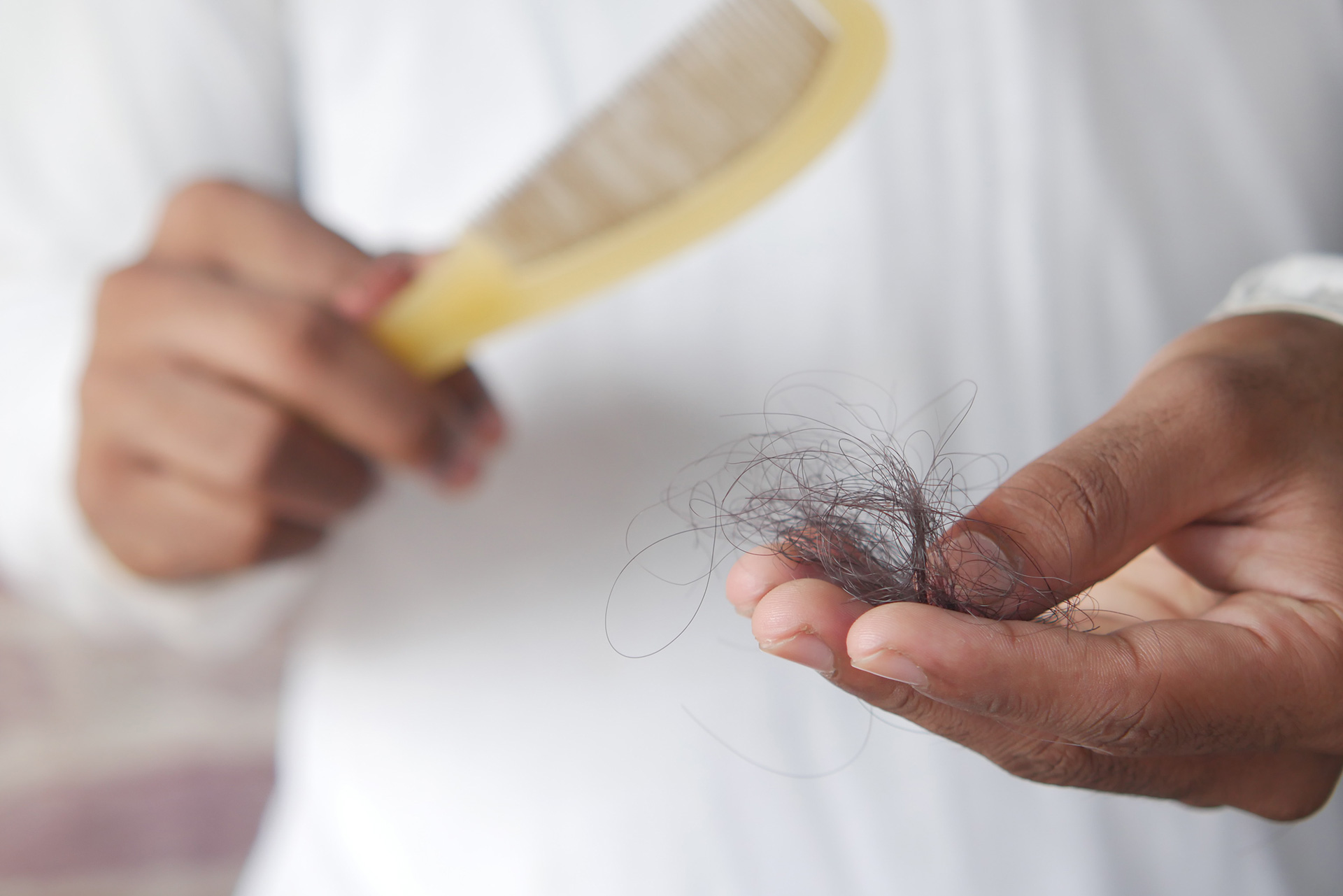 La caída de pelo es uno de los síntomas más comunes de la esclerodermia