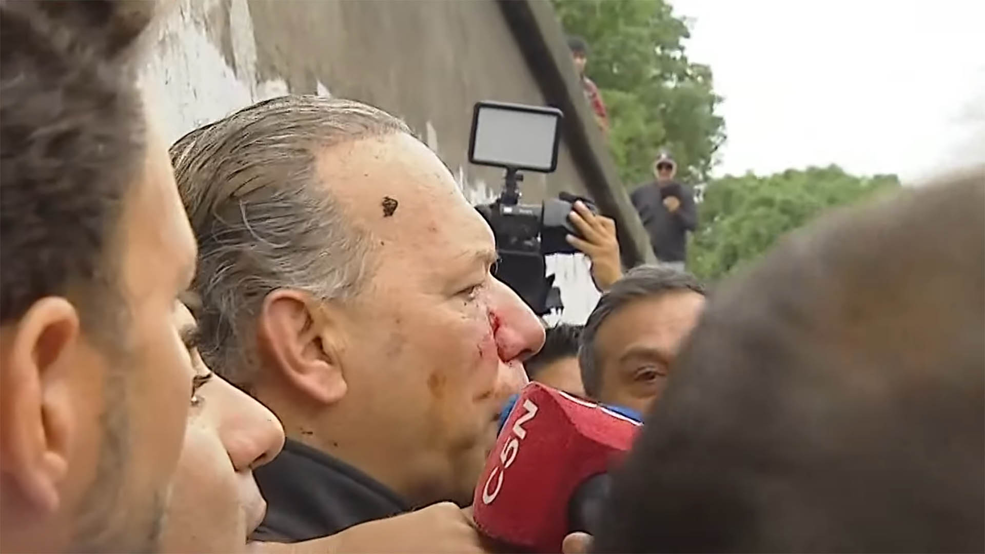 Captura de pantalla: las heridas en el rostro del ministro Berno