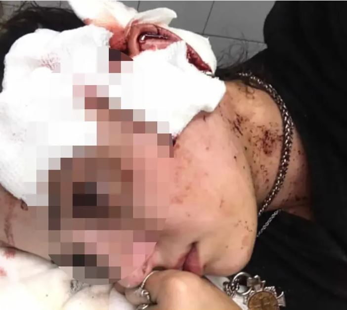 La moza de 21 años brutalmente agredida en Mendoza (Foto: Los Andes)