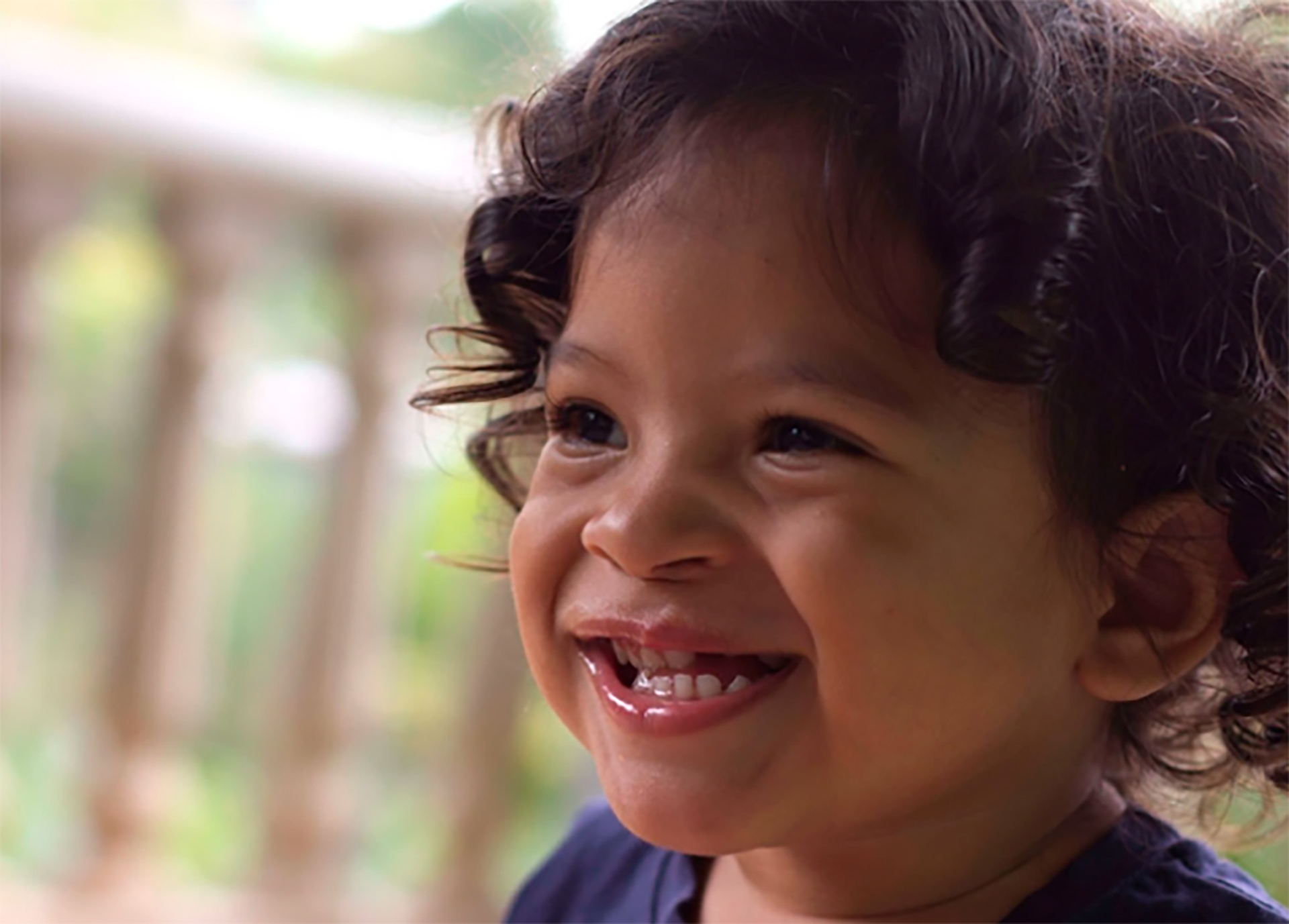 Marco, un niño pañameno que pudo operarse gracias a la ayuda de Smile Train (foto: ONG Smile Train)