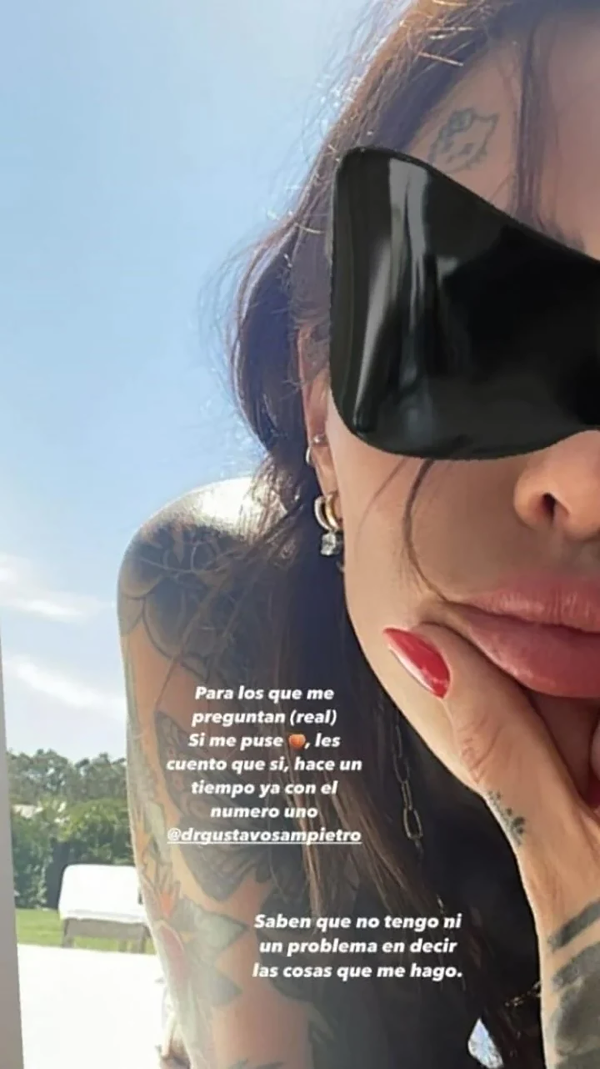 Cande Tinelli se encargó de aclarar que se operó los glúteos en Instagram