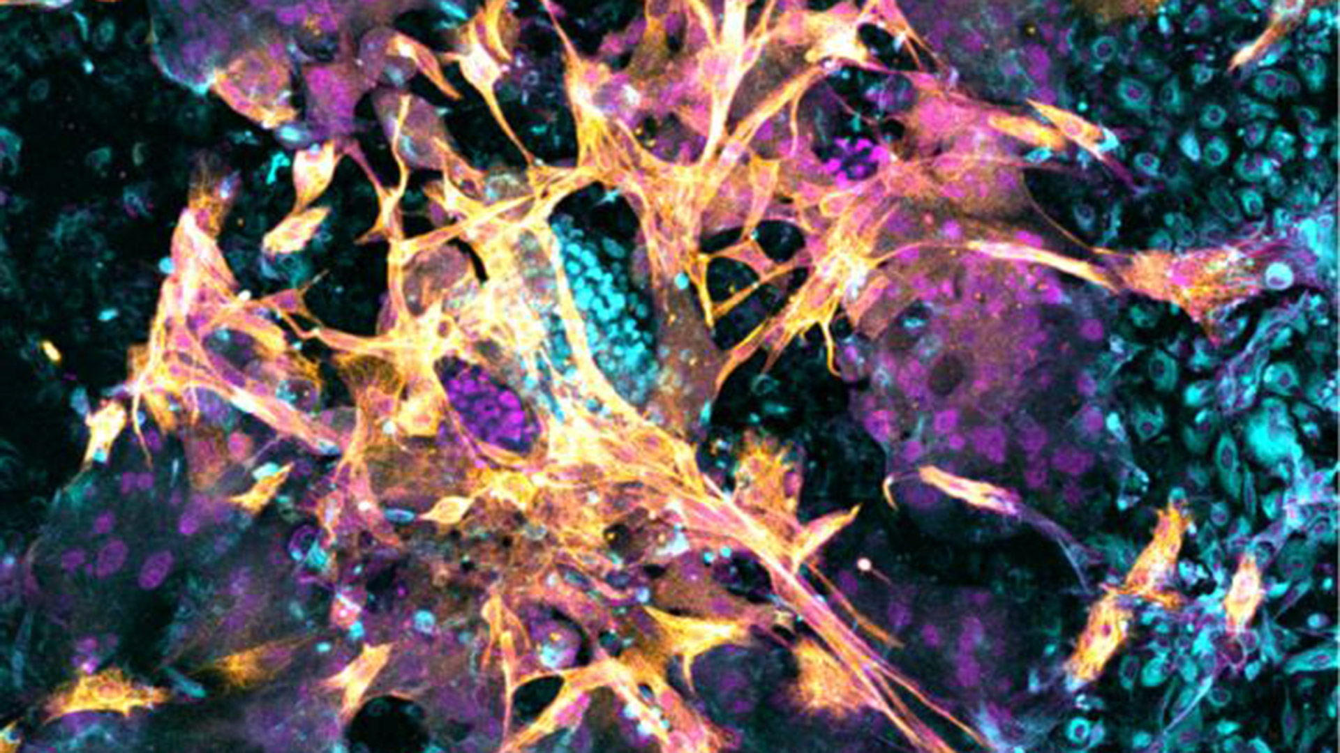 Los planes de Jorge Macri para 2026: una ciudad sitiada de obras en busca de la reelección