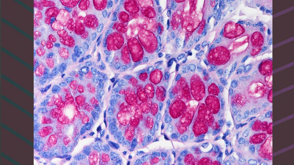 Una imagen de criptas intestinales en el colon de un ratón sano. Fue tomada por la científica Anabela Cutine (Lab de Glicómica Funcional y Molecular/Lab. de Inmunopatología, IBYME) y María May (patóloga independiente)/Conicet