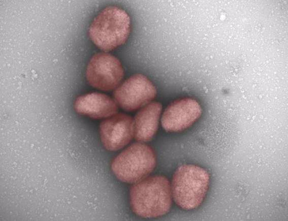 De acuerdo a estos científicos, se ha detectado ADN viral de la viruela del mono en líquido seminal (Europa Press)