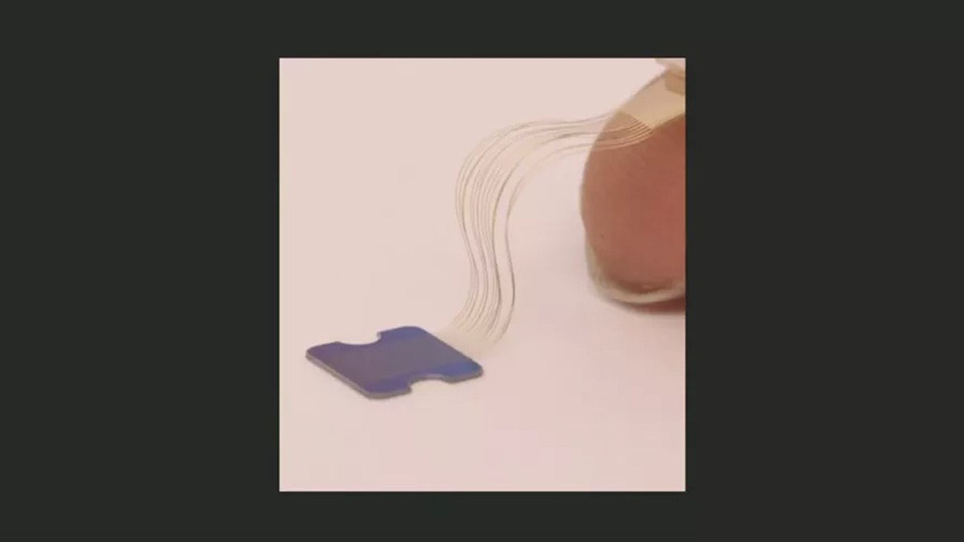 Así son los pequeños hilos que funcionan como sensores que recopilan información de la materia gris del cerebro.