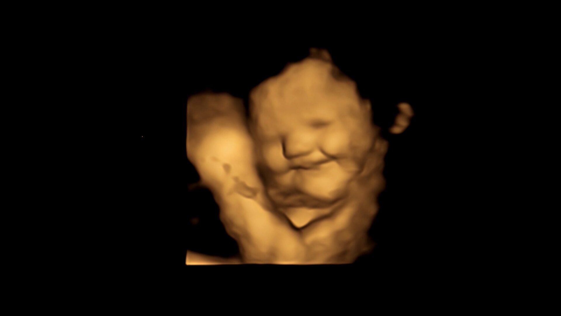 La imagen de un escaneo 4D de un feto que muestra una reacción de cara de risa después de haber estado expuesto al sabor a zanahoria / Crédito: Estudio FETAP (Preferencias de sabor fetal), Laboratorio de Investigación Fetal y Neonatal, Universidad de Durham