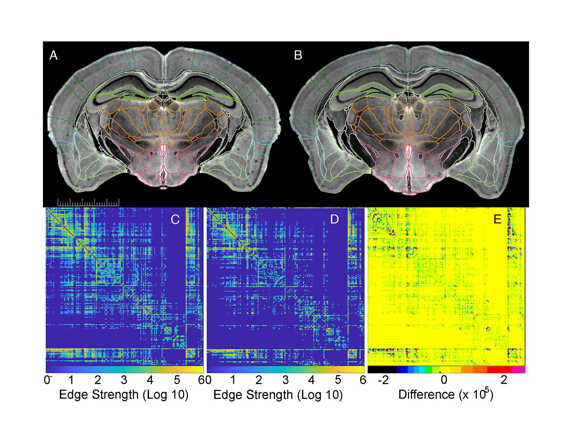 La figura muestra en detalle la diferencia entre los cerebros de los ratones mayores y los menores (G. Allan Johnson, Yuqi Tian, David G. Ashbrook y Robert W. Williams)