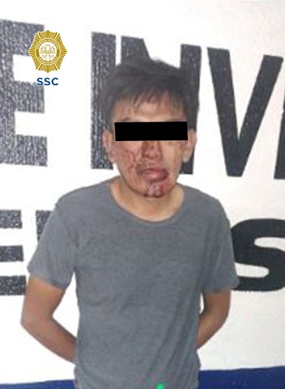 Detenido por intento de violación dentro del Hospital Balbuena (SSC)