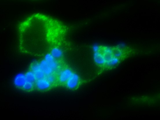 Al igual que el hongo Cryptococcus gatii, que ahora llegó hasta las regiones templadas, otros hongos similares también ampliaron su presencia geográfica /Archivo