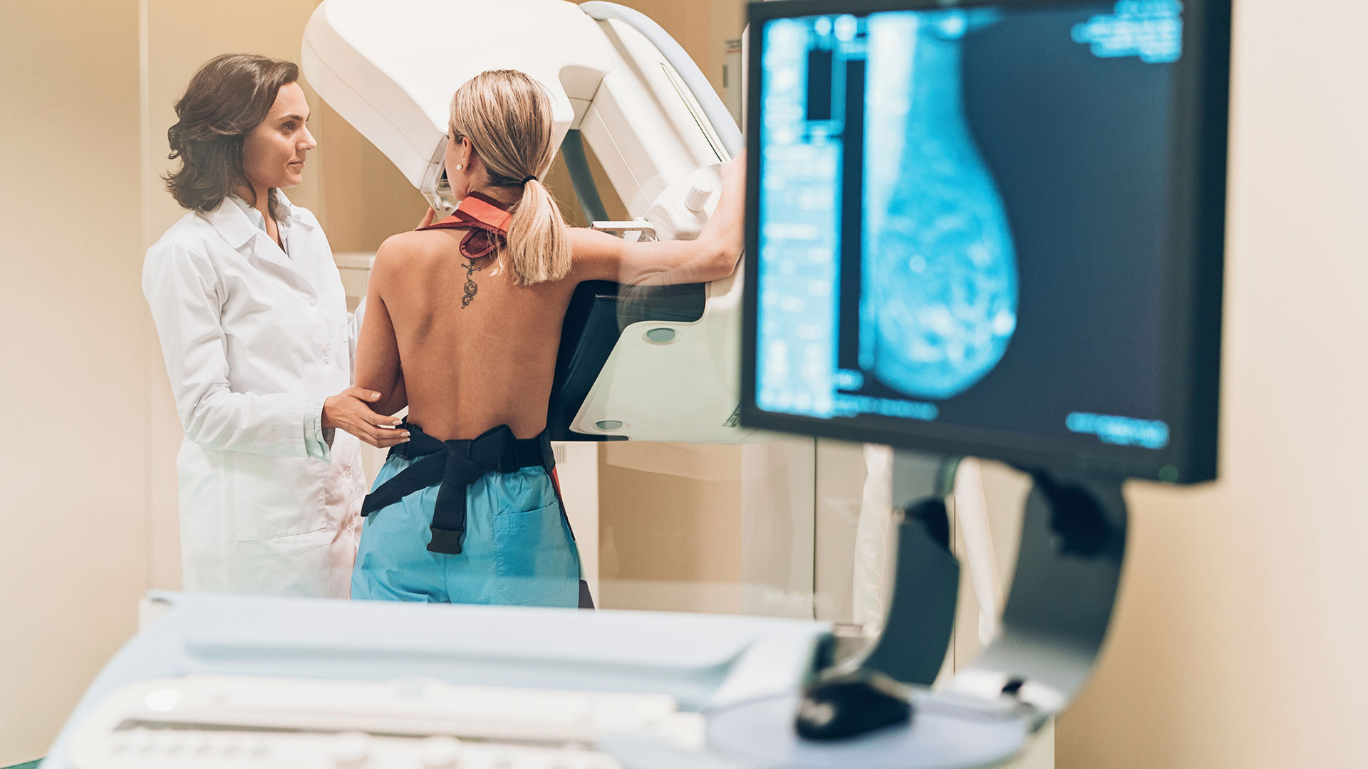 La mamografía los especialistas la están recomendando a partir de los 40 años (Gettyimages)