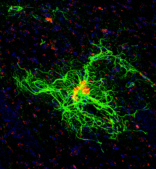 Immunofluorescence confocal microscopy shows that reactive astrocytes (green) surround amyloid plaques (red) in the aged, outbred degu brain.

CREDIT
UCI School of Medicine

USAGE RESTRICTIONS