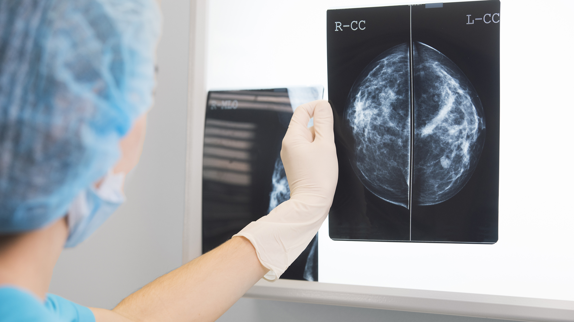La Noche de las Mamografías: cómo es la campaña para concientizar sobre el cáncer de mama