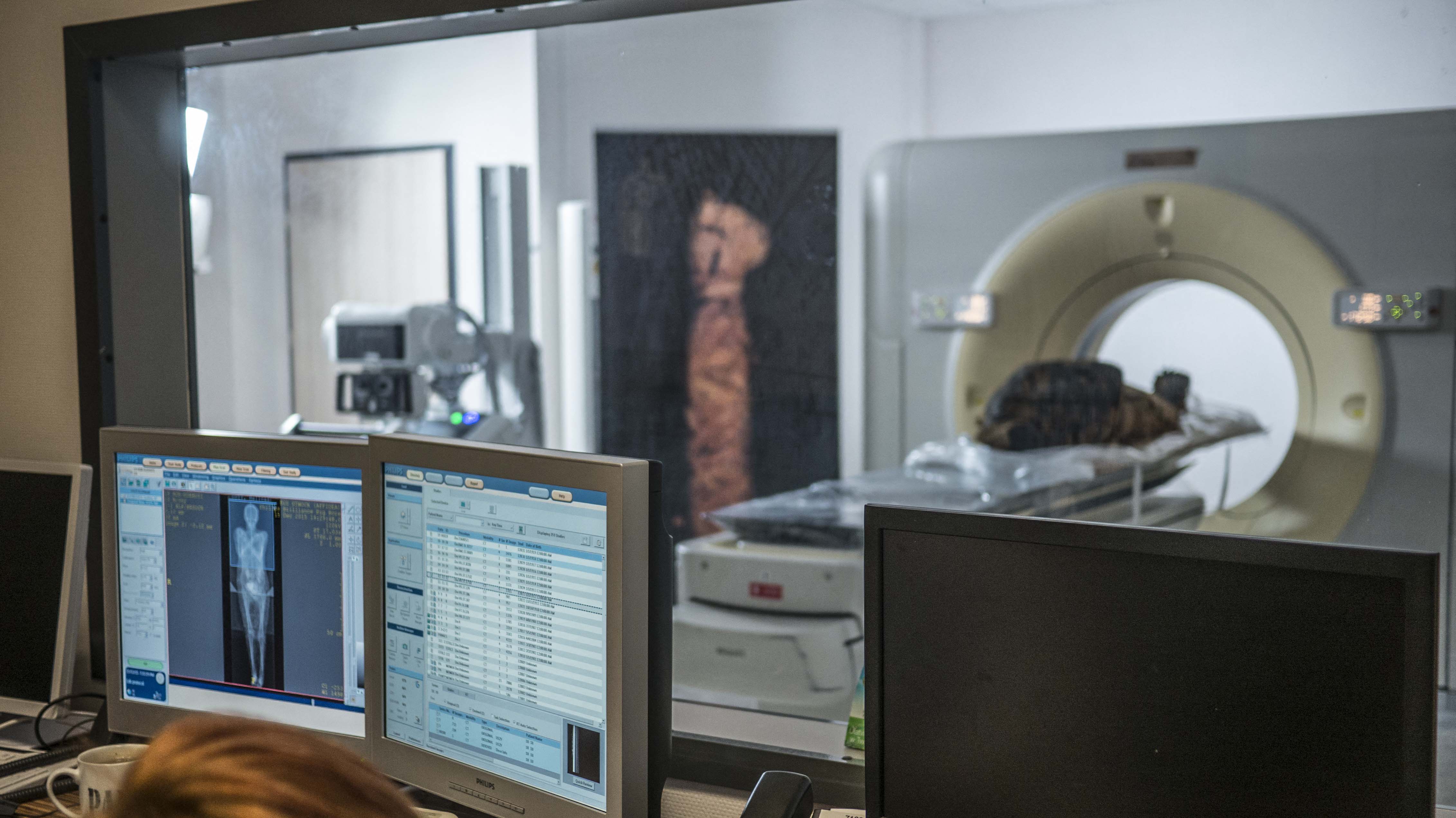 Esta imagen muestra a los arqueólogos viendo imágenes de rayos X de la momia egipcia embarazada tomadas el 15 de diciembre de 2015 en un centro médico en Otwock cerca de Varsovia, Polonia (AFP)
