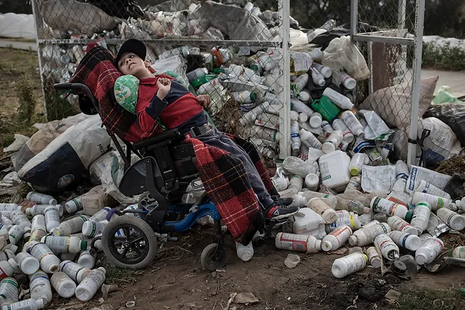 Niño con hidrocefalia en Villa Guerrero se posa junta a botellas de agroquímicos, responsables de su condición. Foto: Cristopher Rogel Blanquet