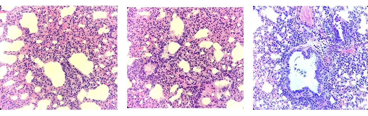El tejido pulmonar de ratones infectados con una cepa recientemente desarrollada del coronavirus muestra signos de daño severo (Crédito: David Walker)

