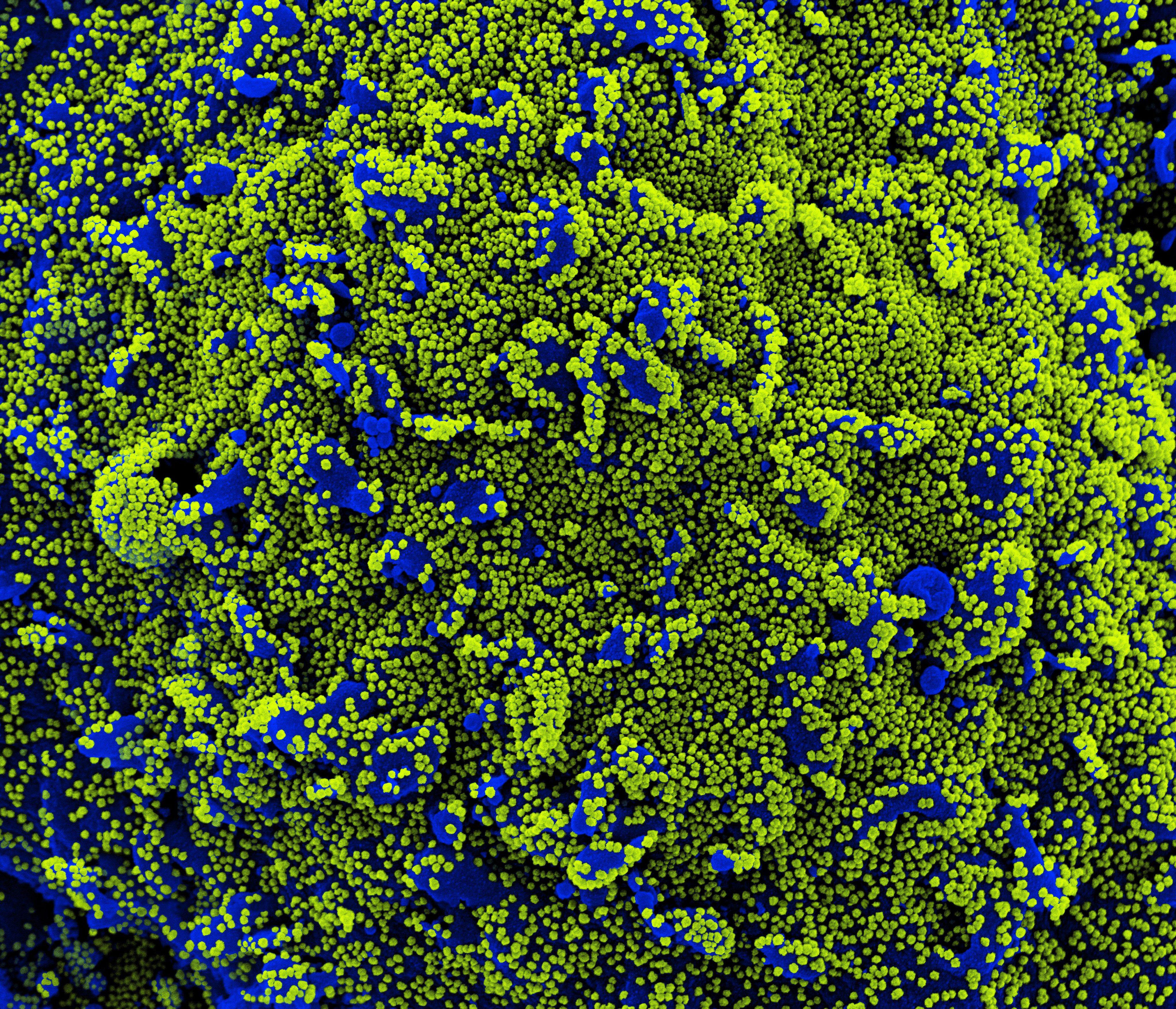 El Coronavirus es visto bajo un microscopio electrónico. (NIAID/National Institutes of Health) 