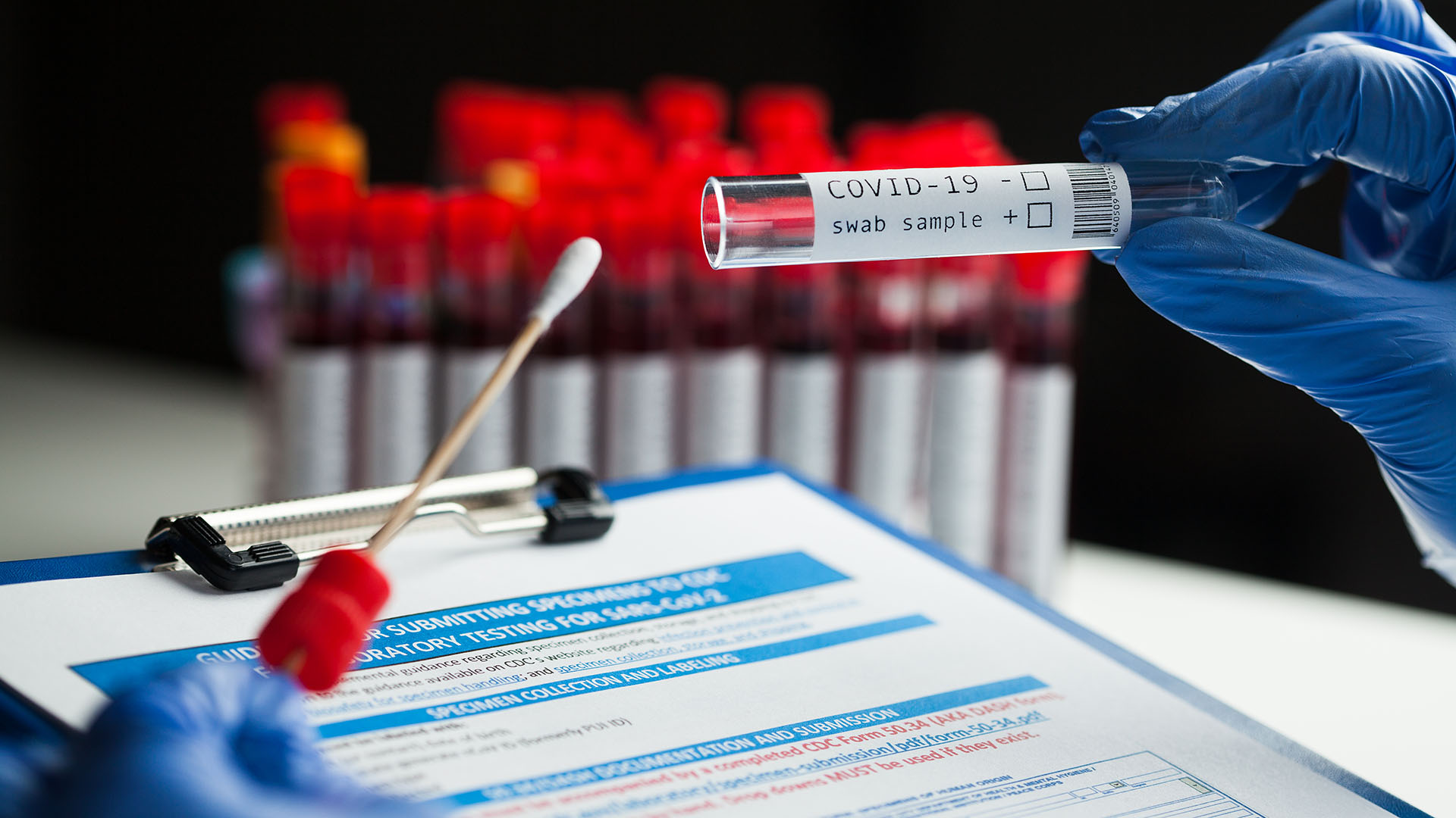 Las pruebas de diagnóstico se dividen en dos categorías principales: pruebas moleculares que detectan el ARN viral y pruebas serológicas que detectan inmunoglobulinas anti-SARS-CoV-2 (Shutterstock)