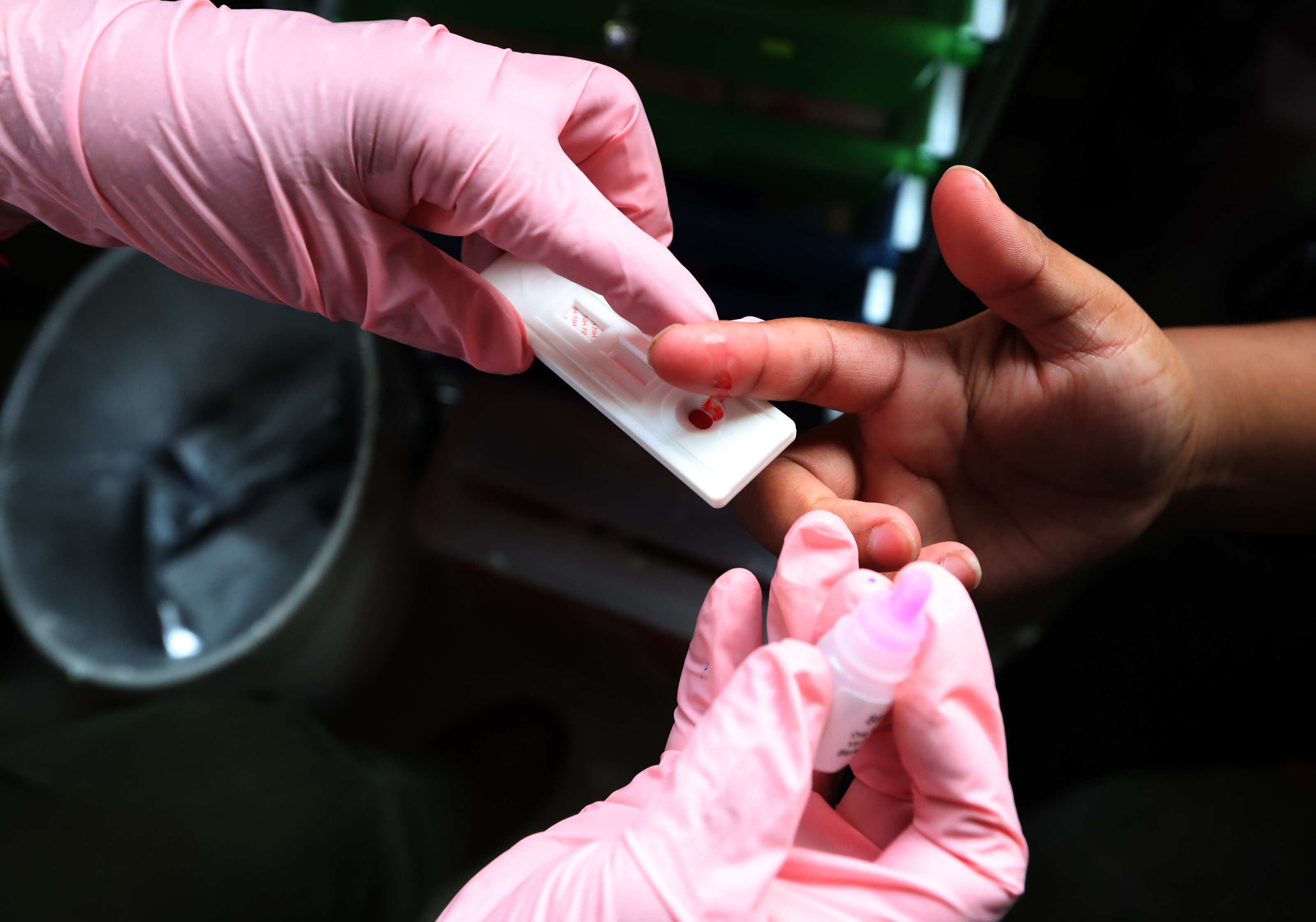 Durante la edición anterior de la Noche de los Testeos se observó que el 46% de los test de VIH realizados por AHF Argentina que resultaron positivos, fueron personas que llegaron tarde a su diagnóstico (presentadores tardíos), informó esa organización
