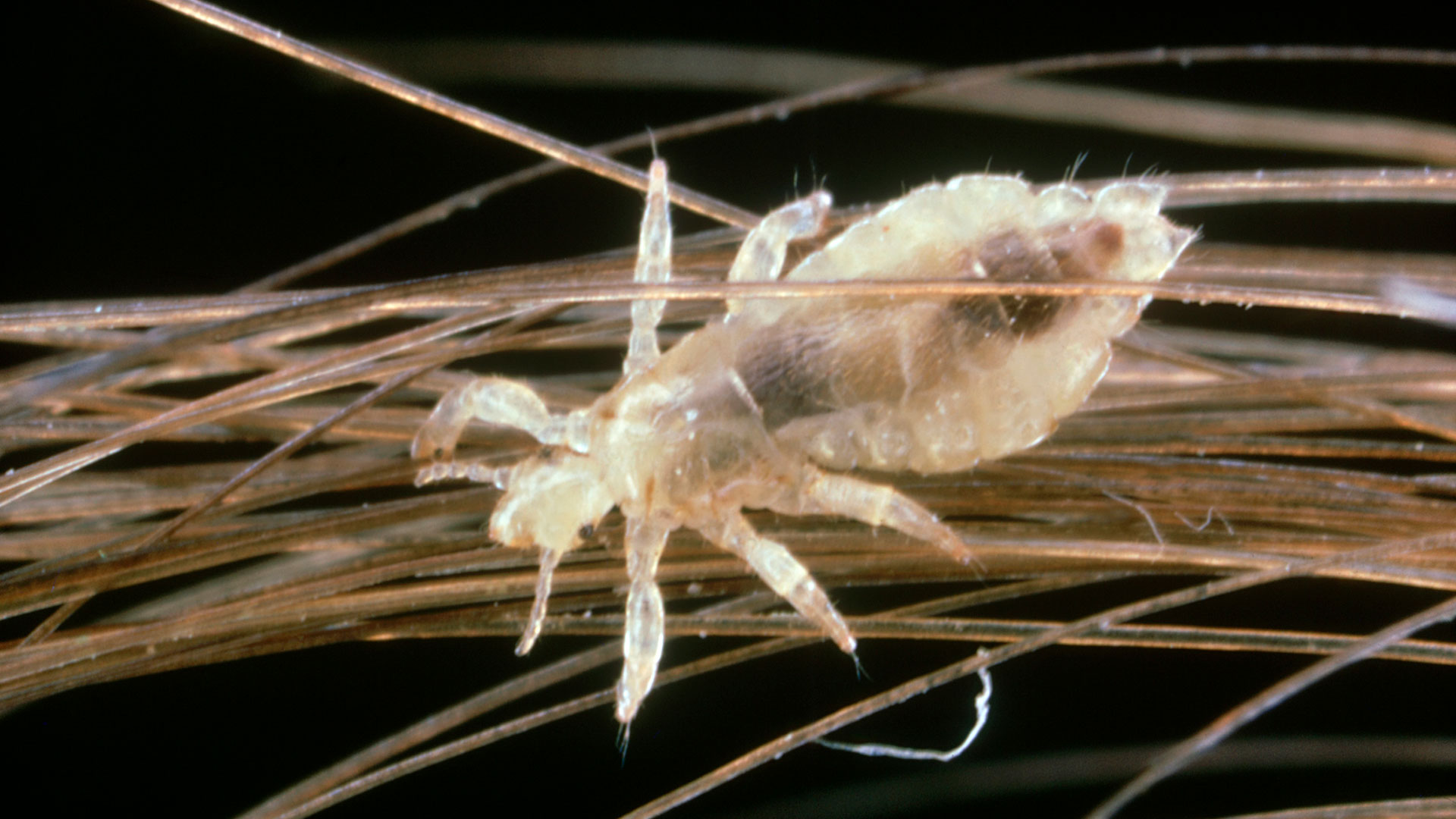 El piojo de la cabeza, o Pediculus humanus capitis , es un insecto parásito (Getty)