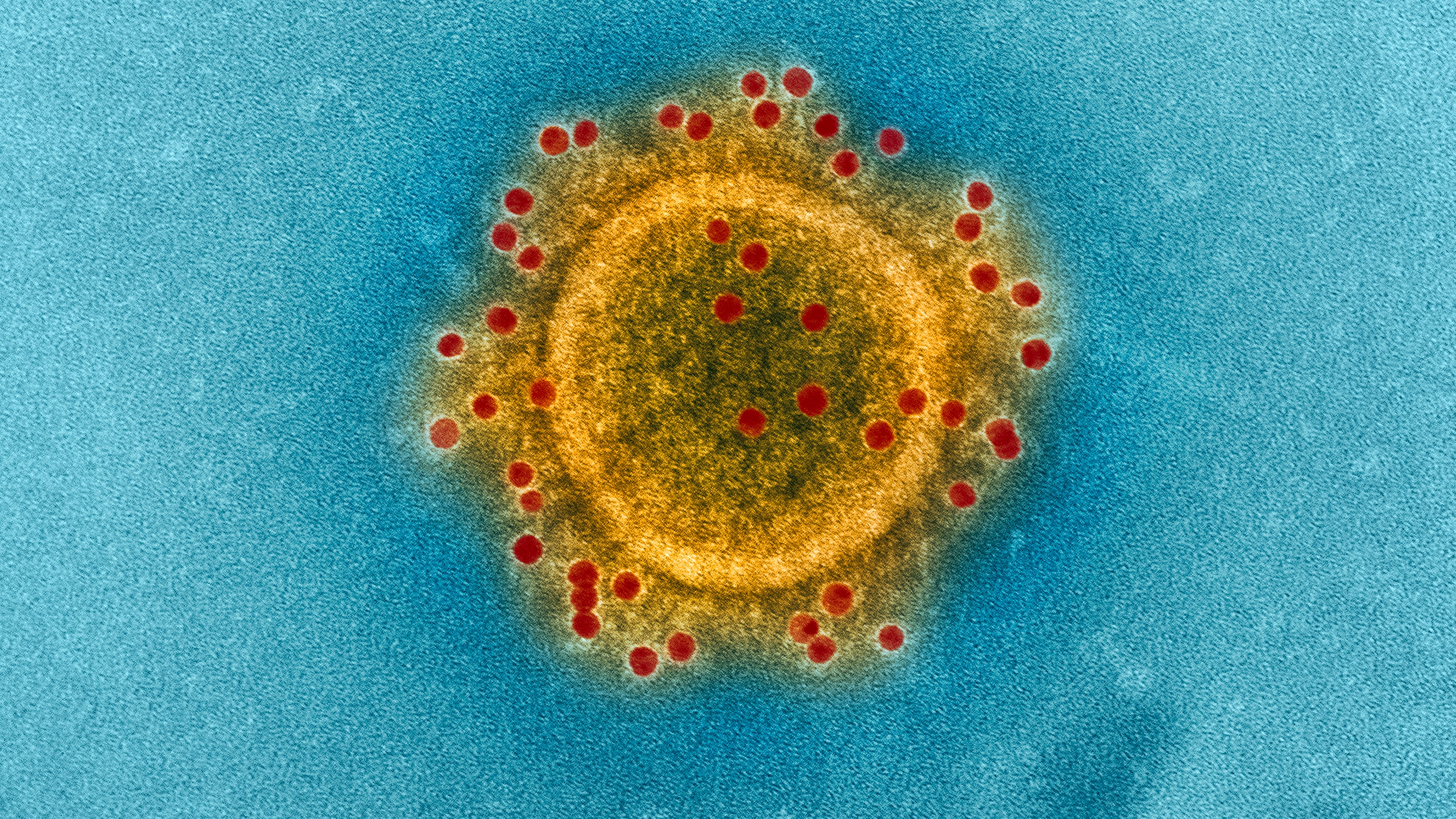 El SARS-CoV-2, visto bajo un microscopio electrónico, ya infectó a más de 321 millones de personas en todo el mundo  (NIAID) 