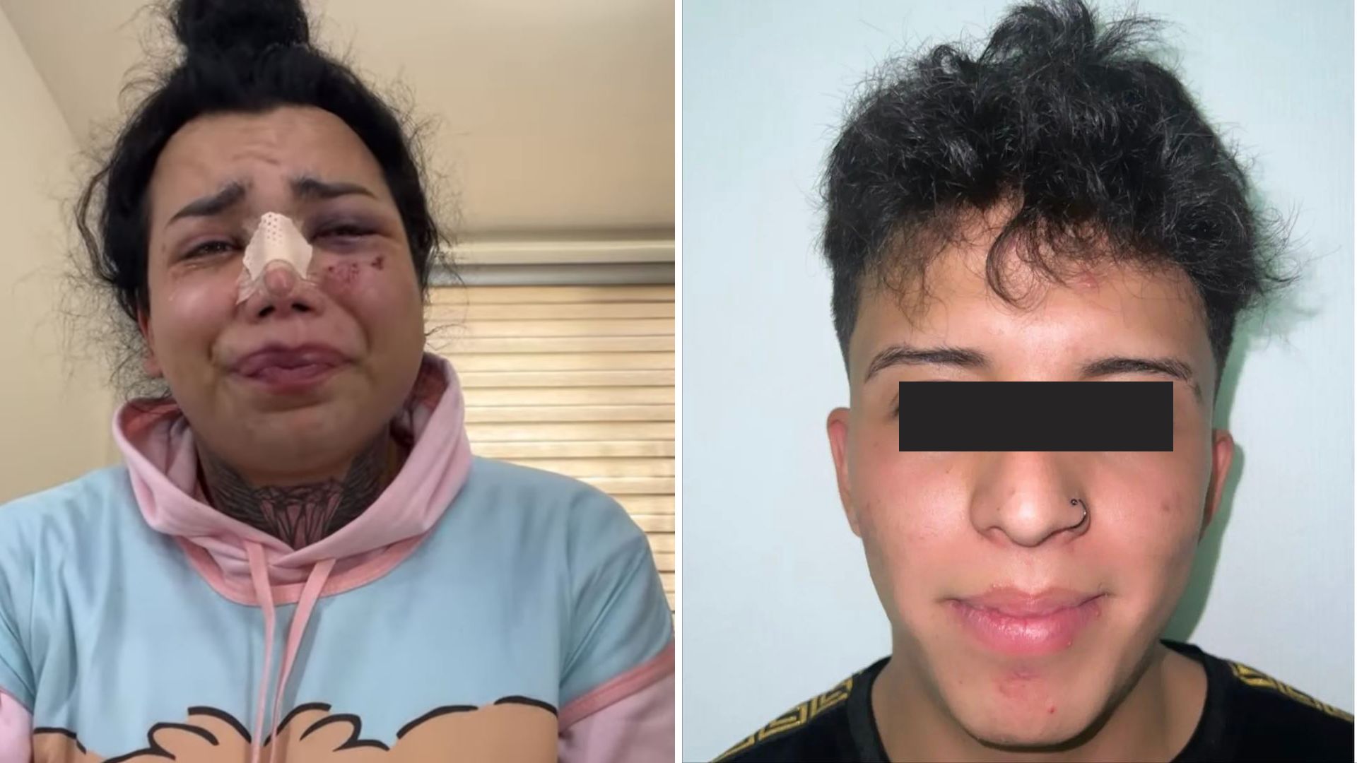 Paola Suárez asegura que ya perdonó a su exnovio tras agresión: “Va a pagar  todo lo que me hizo” - Infobae