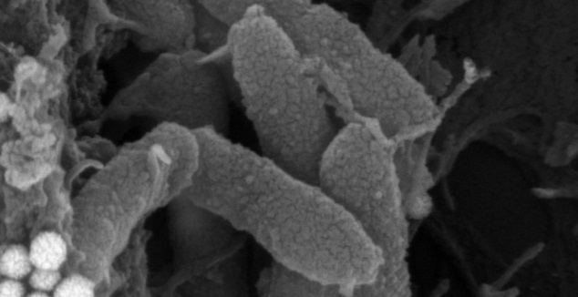 Imagen de la bacteria &quot;Pseudomonas aeruginosa&quot; vista a trav&#233;s de un microscopio. EFE/Cedida por el Consejo Superior de Investigaciones Cient&#237;ficas (CSIC)
