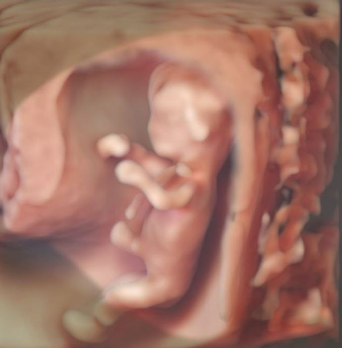 Esta es la imagen del bebé a 11 semanas de gestación. (Captura: @justyoss/Instagram)