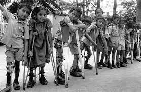 En 1 de cada 200 casos el virus de la polio destruye partes del sistema nervioso y provoca la parálisis permanente en piernas o brazos/OMS