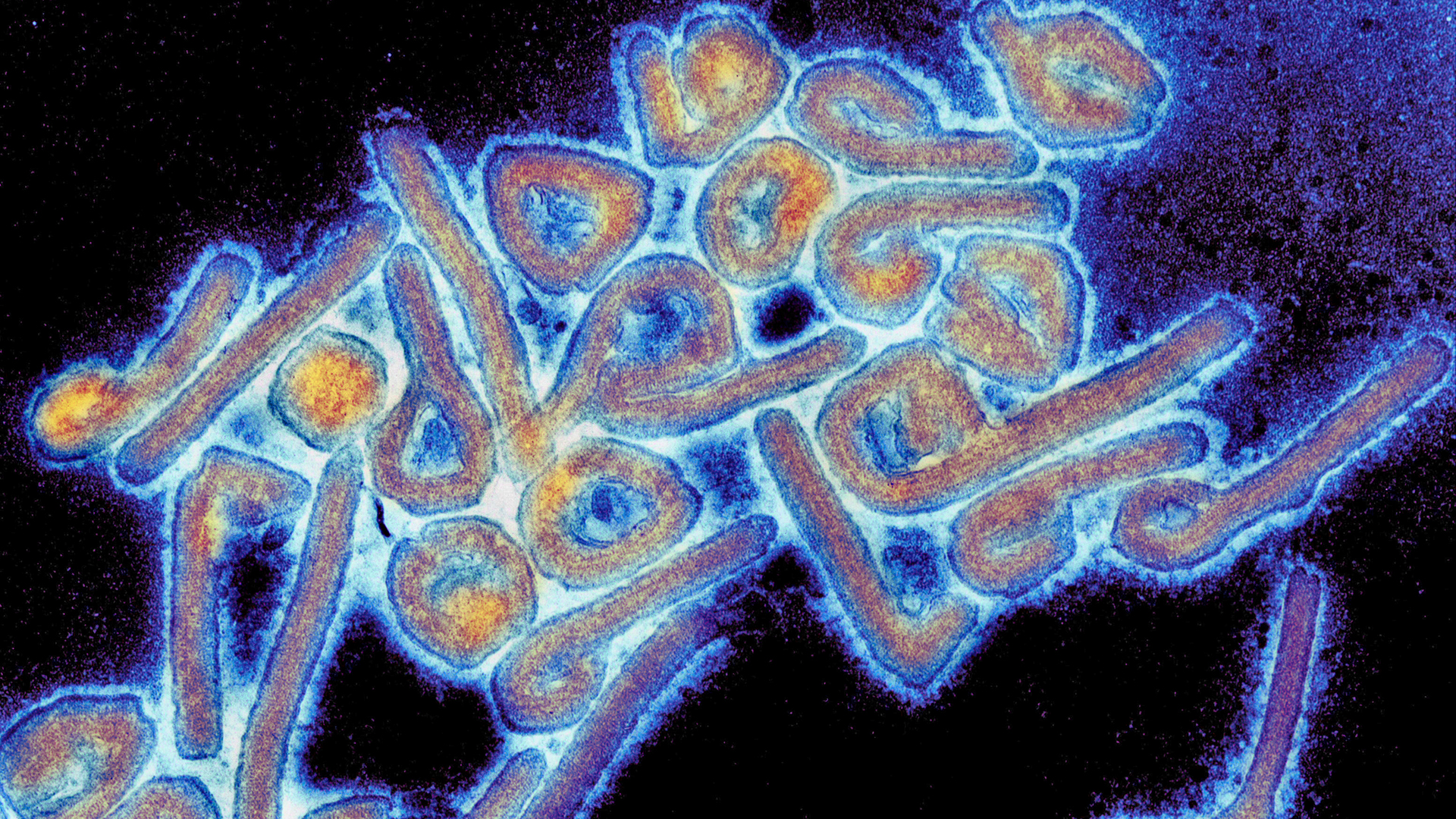 Virus de Marburgo: desde el inicio de los brotes hubo 41 muertos en Guinea Ecuatorial y Tanzania 
